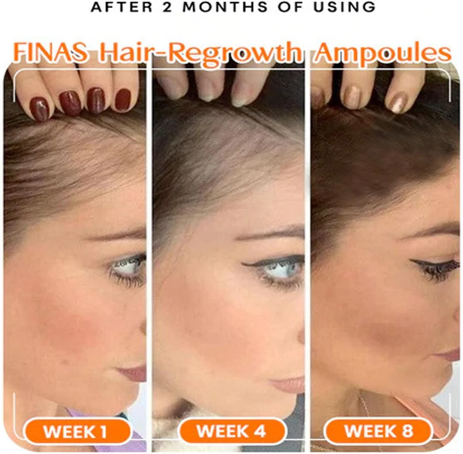 آمپول های احیا کننده مو Liasc FINAS Prestig، لوسیون سرم آمپول رشد مو Liasc Hairmuch، سرم رشد مو بیوتین، ضخیم کننده و احیا کننده مو برای موهای نازک (56 عدد/8 جعبه) آمپول های احیا کننده مو Liasc FINAS Prestig، لوسیون سرم آمپول رشد مو Liasc Hairmuch، سرم رشد مو بیوتین، ضخیم کننده و احیا کننده مو برای موهای نازک (56 عدد/8 جعبه)