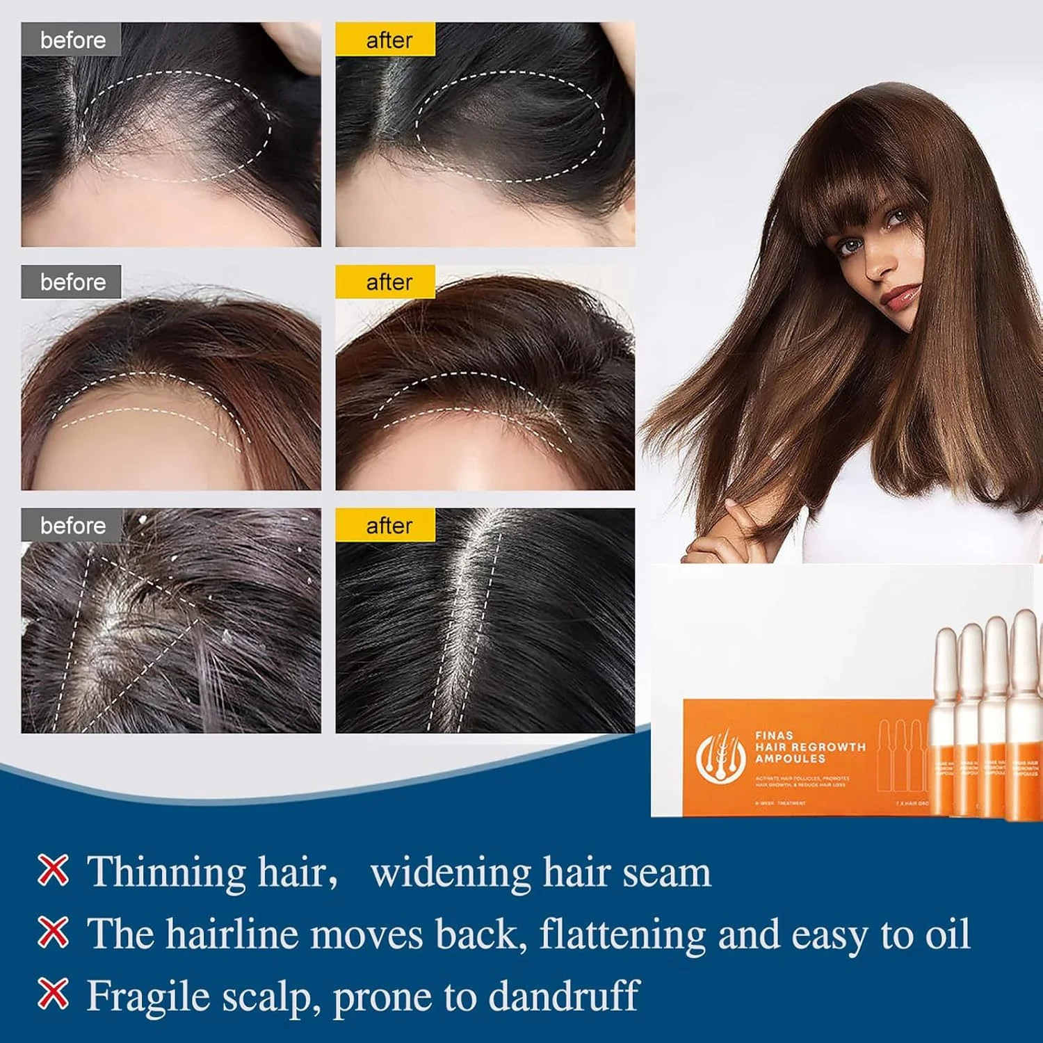 آمپول های احیا کننده مو Liasc FINAS Prestig، لوسیون سرم آمپول رشد مو Liasc Hairmuch، سرم رشد مو بیوتین، ضخیم کننده و احیا کننده مو برای موهای نازک (56 عدد/8 جعبه) آمپول های احیا کننده مو Liasc FINAS Prestig، لوسیون سرم آمپول رشد مو Liasc Hairmuch، سرم رشد مو بیوتین، ضخیم کننده و احیا کننده مو برای موهای نازک (56 عدد/8 جعبه)