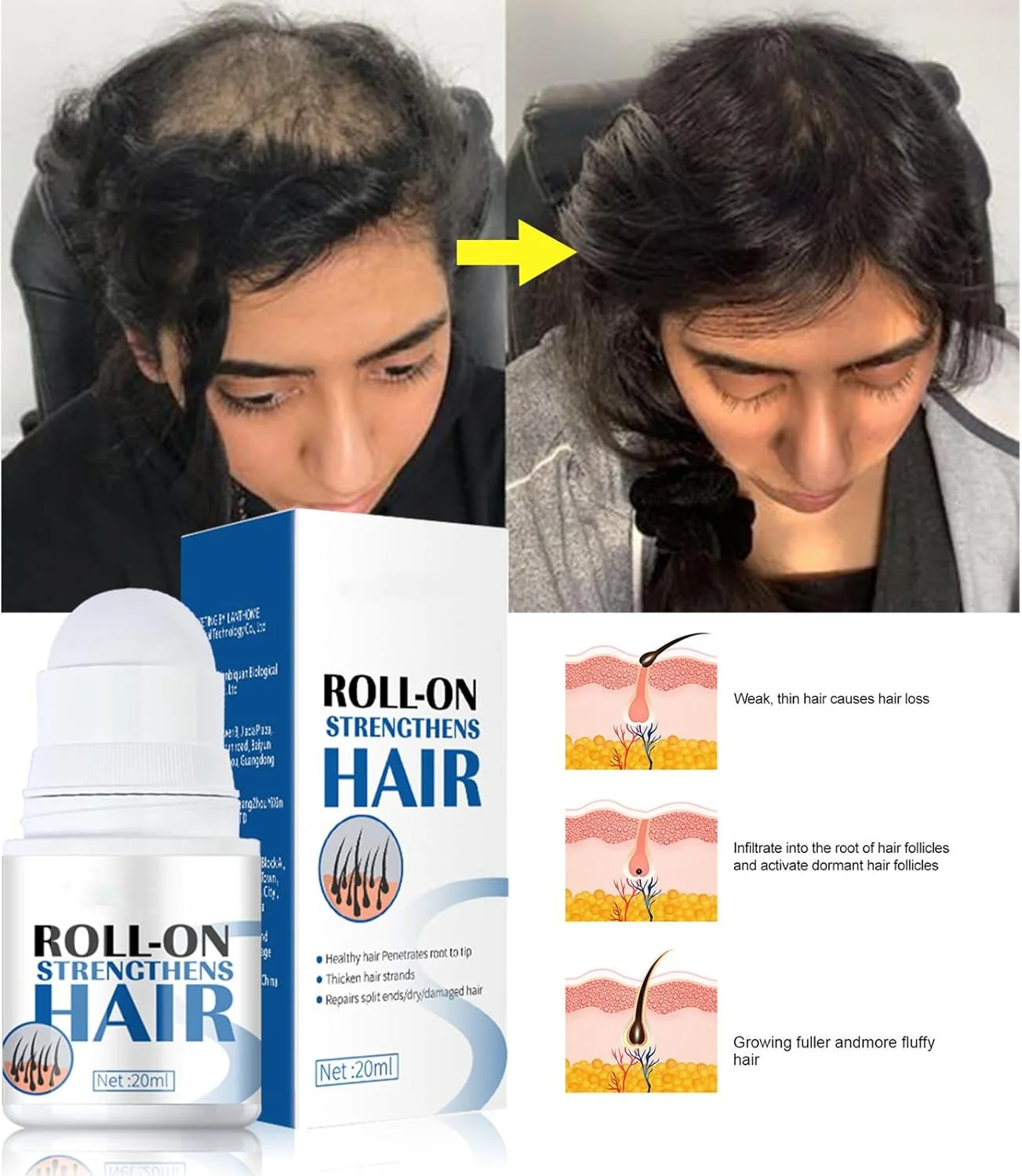 سرم رشد مو - سرم روغنی تقویت کننده و مغذی طبیعی پوست سر برای زنان و مردان - روغن رشد مو رولی - نرم کننده، مغذی و تقویت کننده مو سرم رشد مو - سرم روغنی تقویت کننده و مغذی طبیعی پوست سر برای زنان و مردان - روغن رشد مو رولی - نرم کننده، مغذی و تقویت کننده مو