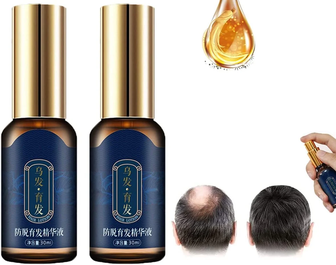 اسپری تقویت کننده مو ZOKU-HGP، اسپری محرک مو، سرم رشد مو Polygonum Multiflorum، روغن های ضروری زنجبیل برای رشد مو مردان و زنان 30 میلی لیتر (2 عدد)