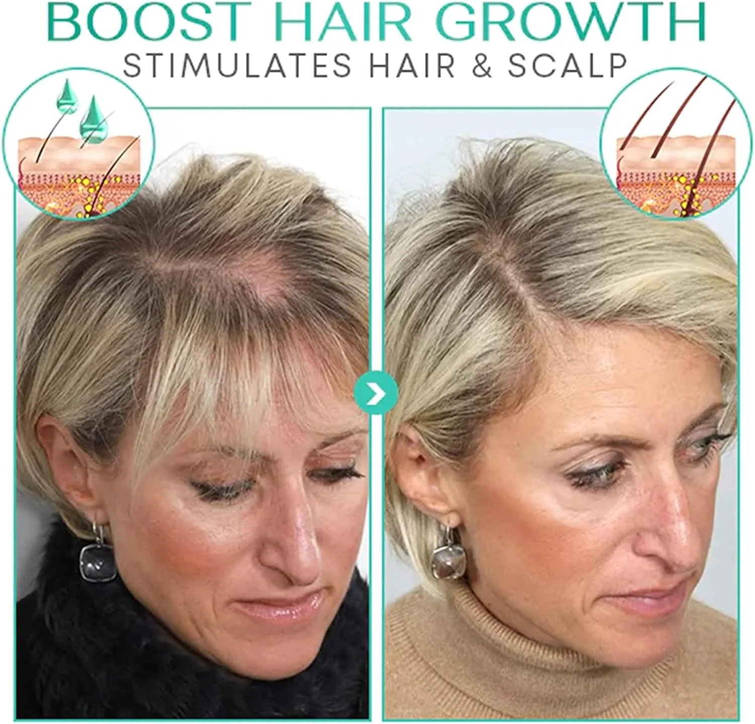 سرم موی فعال کننده مو Puragro Suma، درمان سرمی فعال کننده مو Pura'Gro Suma، روغن کرچک برای رشد مو، سرم ضد ریزش مو، تقویت کننده رشد موهای ضخیم تر و قوی تر (2 عدد، برای مو) سرم موی فعال کننده مو Puragro Suma، درمان سرمی فعال کننده مو Pura'Gro Suma، روغن کرچک برای رشد مو، سرم ضد ریزش مو، تقویت کننده رشد موهای ضخیم تر و قوی تر (2 عدد، برای مو)