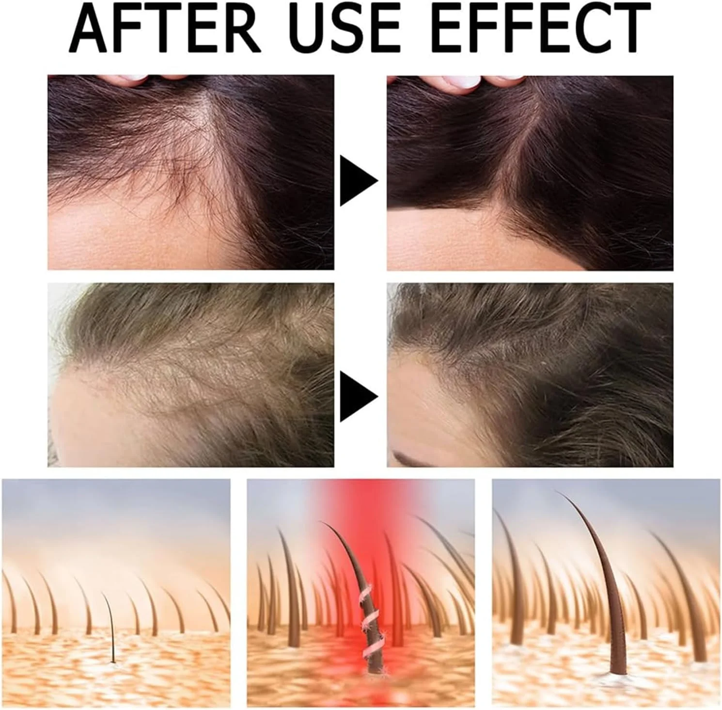 آمپول های تقویت کننده رشد مو - سرم رشد مو برای جلوگیری از ریزش و نازک شدن مو، تقویت کننده مو آمپول های تقویت کننده رشد مو - سرم رشد مو برای جلوگیری از ریزش و نازک شدن مو، تقویت کننده مو