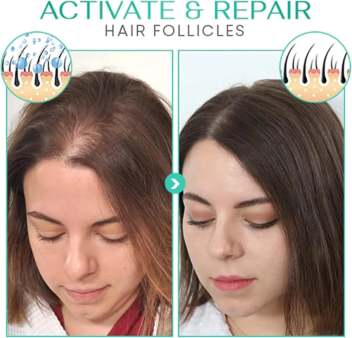 سرم موی فعال کننده مو Puragro Suma، درمان سرمی فعال کننده مو Pura'Gro Suma، روغن کرچک برای رشد مو، سرم ضد ریزش مو، تقویت کننده رشد موهای ضخیم تر و قوی تر (2 عدد، برای مو) سرم موی فعال کننده مو Puragro Suma، درمان سرمی فعال کننده مو Pura'Gro Suma، روغن کرچک برای رشد مو، سرم ضد ریزش مو، تقویت کننده رشد موهای ضخیم تر و قوی تر (2 عدد، برای مو)