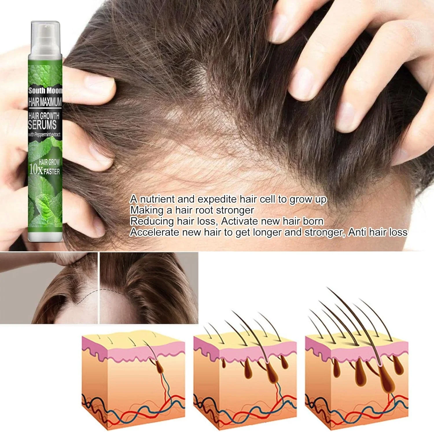 اسانس رشد مو - اسانس گیاهی برای رشد مو، سرم درمان ریزش مو، تغذیه ریشه، مراقبت سریع از مو برای مردان و زنان اسانس رشد مو - اسانس گیاهی برای رشد مو، سرم درمان ریزش مو، تغذیه ریشه، مراقبت سریع از مو برای مردان و زنان