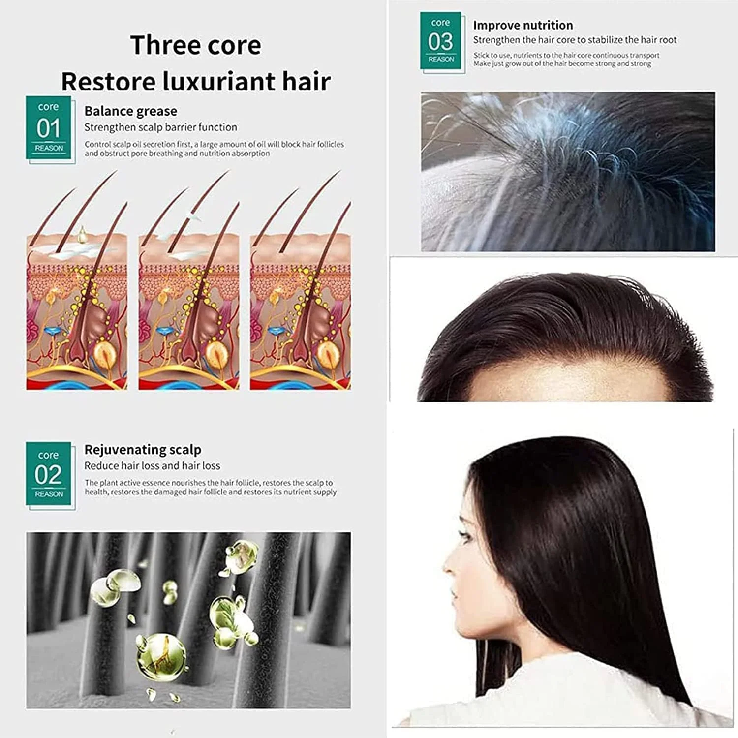 سرم فعال کننده مو، روغن کرچک برای رشد مو، ضد ریزش مو، تقویت کننده رشد موهای ضخیم تر و قوی تر، مناسب برای انواع مو، 30 میلی لیتر (1 عدد، برای پوست سر) سرم فعال کننده مو، روغن کرچک برای رشد مو، ضد ریزش مو، تقویت کننده رشد موهای ضخیم تر و قوی تر، مناسب برای انواع مو، 30 میلی لیتر (1 عدد، برای پوست سر)