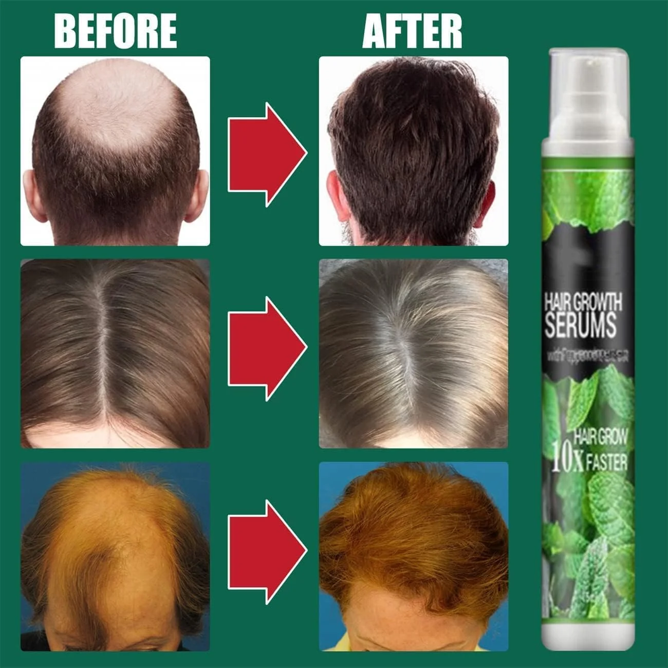 اسپری اسانس گیاهی برای رشد مو، جلوگیری از ریزش مو، رشد سریع، جلوگیری از خشکی مو، سرم رشد سریع موی گیاهی طبیعی، جلوگیری از ریزش مو بعد از زایمان، اسپری اسانس گیاهی برای خط رویش مو 10 میلی لیتر (5 عدد)