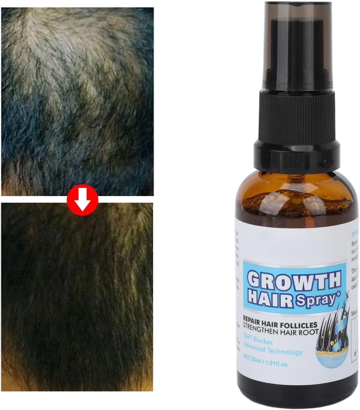 اسپری رشد مو، تقویت کننده رشد مو، سرم رشد موی مردانه و زنانه