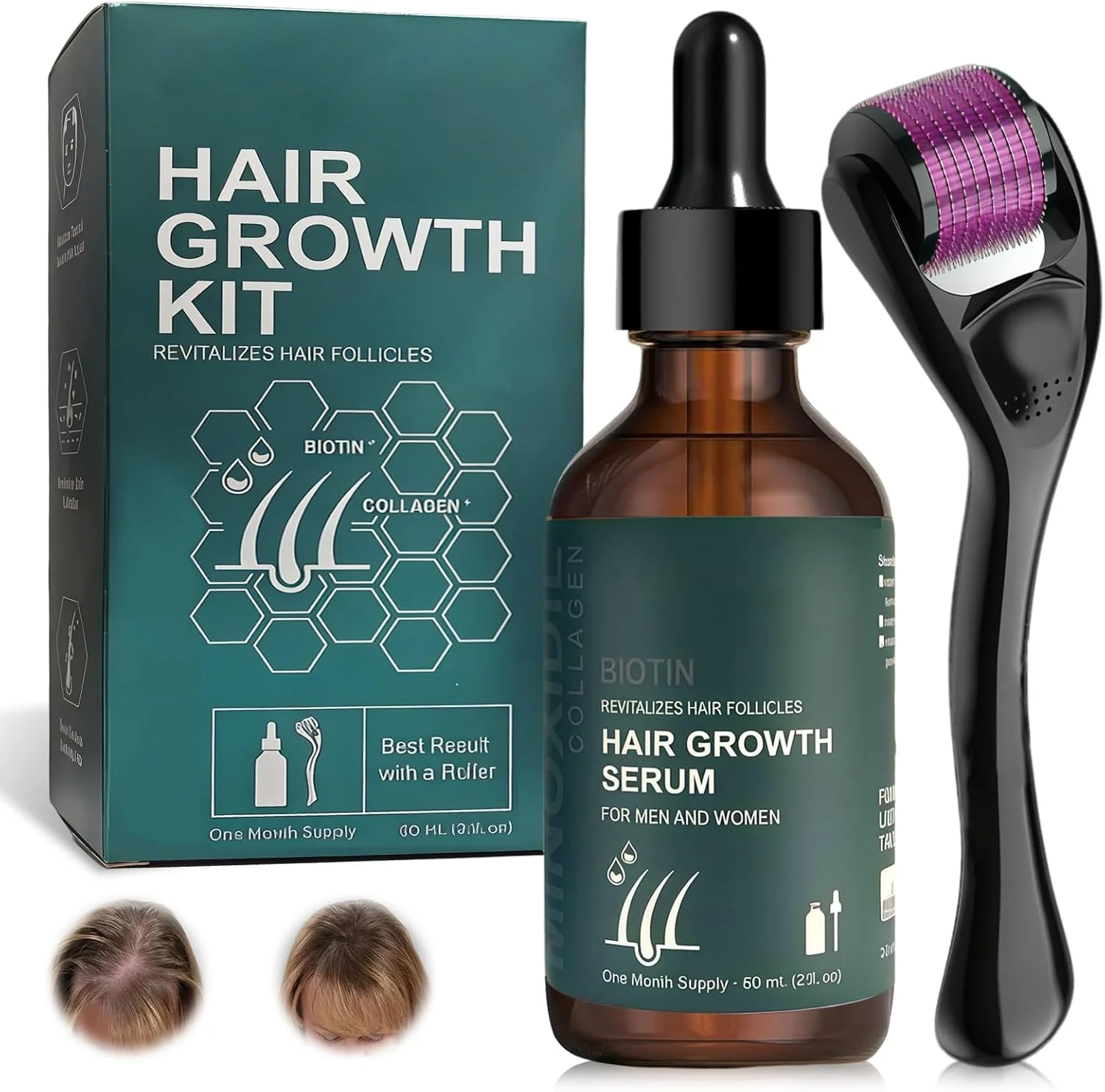 سرم رشد مو 60 میلی لیتری به همراه درمارولر 0.5 میلی متری، سرم رشد مو، سرم های ضد ریزش مو، تقویت کننده رشد مجدد مو سرم رشد مو 60 میلی لیتری به همراه درمارولر 0.5 میلی متری، سرم رشد مو، سرم های ضد ریزش مو، تقویت کننده رشد مجدد مو