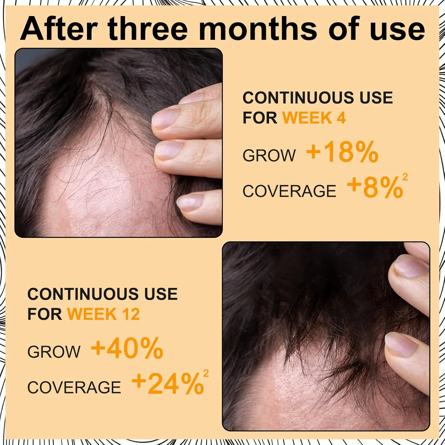 اسپری فوم رشد مو، درمان رشد مجدد مو برای آقایان و خانم ها، سرم رشد مو، ضد ریزش مو، ترمیم فولیکول های مو، درمان ریزش مو برای نقاط طاس و نازک شدن مو، 60 میلی لیتر اسپری فوم رشد مو، درمان رشد مجدد مو برای آقایان و خانم ها، سرم رشد مو، ضد ریزش مو، ترمیم فولیکول های مو، درمان ریزش مو برای نقاط طاس و نازک شدن مو، 60 میلی لیتر