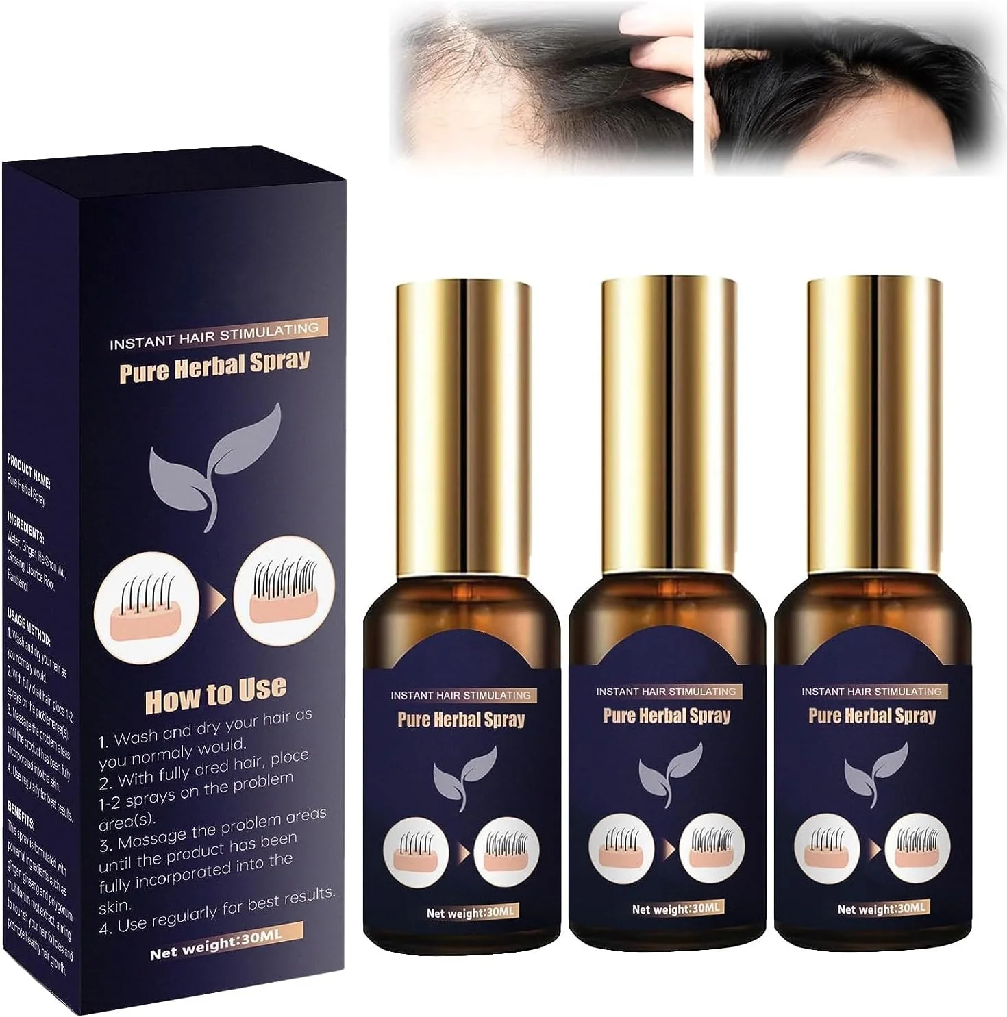 اسپری رشد مو، اسپری گیاهی خالص محرک فوری مو، سرم رشد مو، اسپری گیاهی احیا کننده مو، اسپری زنجبیلی رشد مو، برای جلوگیری از ریزش مو و رشد مجدد مو (3 عدد) اسپری رشد مو، اسپری گیاهی خالص محرک فوری مو، سرم رشد مو، اسپری گیاهی احیا کننده مو، اسپری زنجبیلی رشد مو، برای جلوگیری از ریزش مو و رشد مجدد مو (3 عدد)