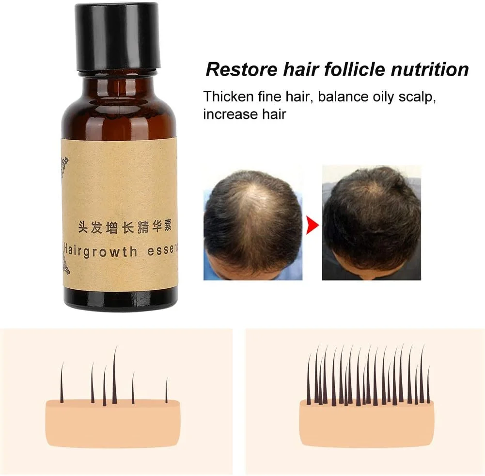 روغن رشد مو، 3 عدد سرم رشد مو 20 میلی لیتری، تغذیه و ترمیم سریعتر مو برای موهای خشک و شکننده