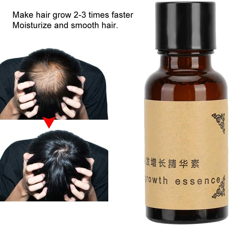 روغن رشد مو، 3 عدد سرم رشد مو 20 میلی لیتری، تغذیه و ترمیم سریعتر مو برای موهای خشک و شکننده