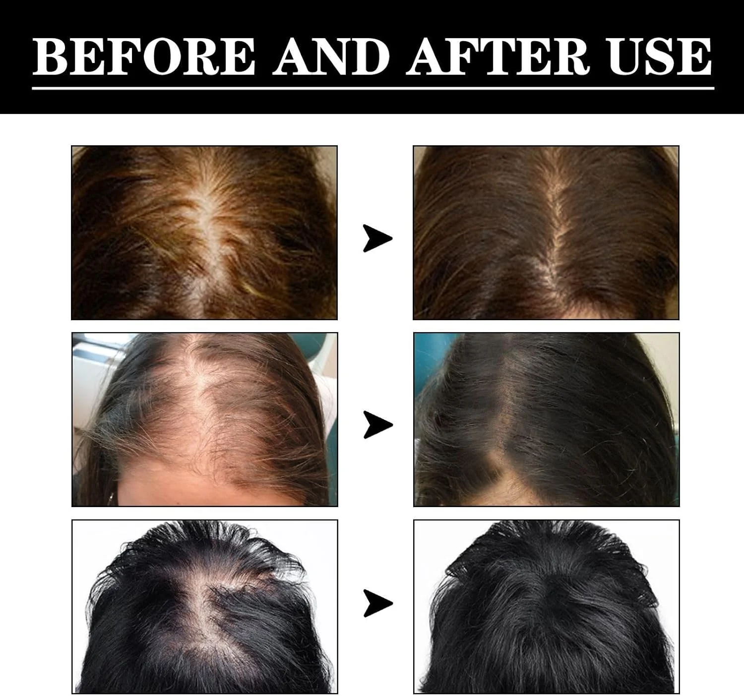 سرم رشد مو نور، روغن زیتون آفریقایی، روغن رشد مو برای جلوگیری از ریزش مو، سرم رشد مو نور برای زنان سفید پوست و سیاه پوست، سرم مو نور لاو، تغذیه کننده موهای خشک و آسیب دیده و ضد ریزش مو (2 عدد)