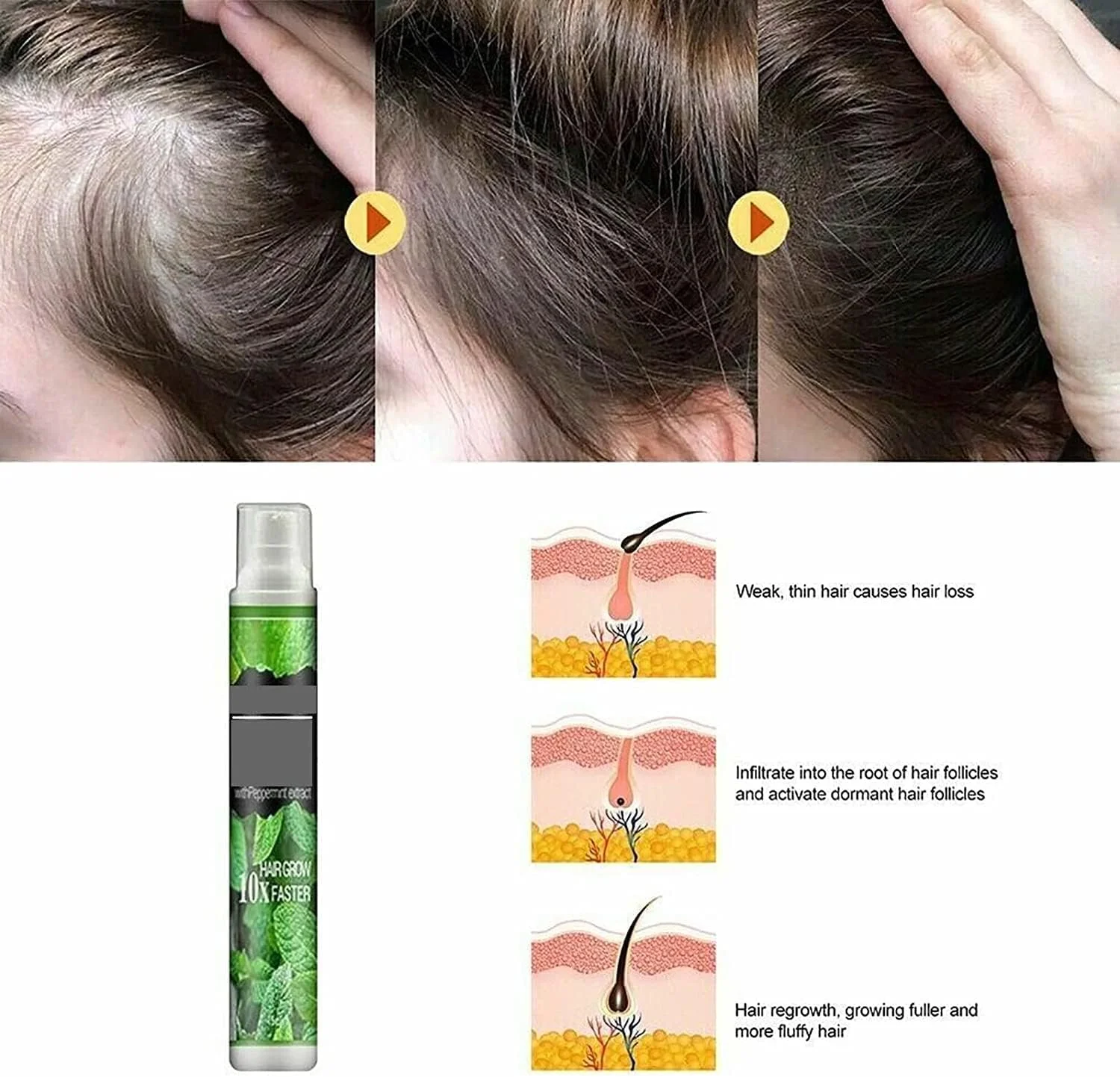 اسپری سرم رشد مو 10 میلی لیتری، اسپری اسانس گیاهی رشد مو، ضد ریزش مو، رشد سریع، جلوگیری از خشکی مو (3 عدد) اسپری سرم رشد مو 10 میلی لیتری، اسپری اسانس گیاهی رشد مو، ضد ریزش مو، رشد سریع، جلوگیری از خشکی مو (3 عدد)