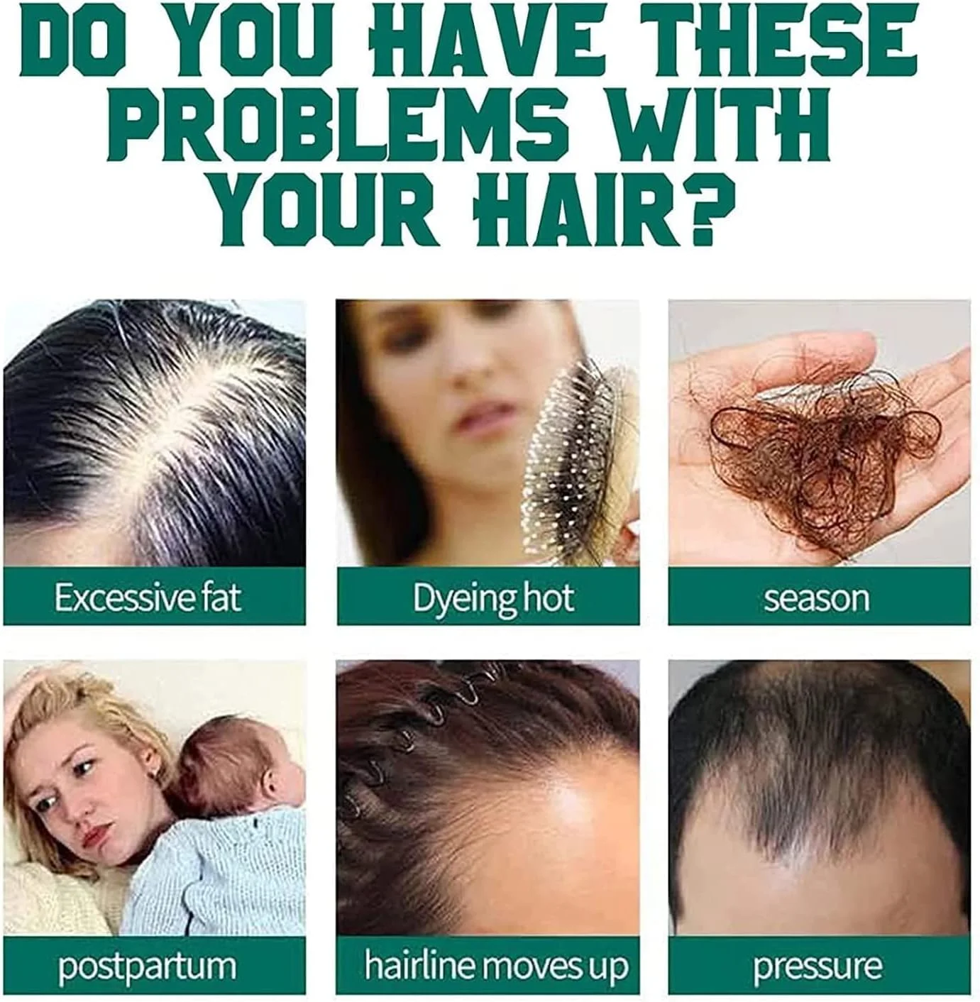 اسپری سرم جینسینگ کره ای برای رشد مجدد مو، اسپری سرم رشد مو زنجبیلی، اسپری زنجبیل مغذی، اسپری زنجبیل رشد مو برای زنان و مردان، 30 میلی لیتر (1 عدد)