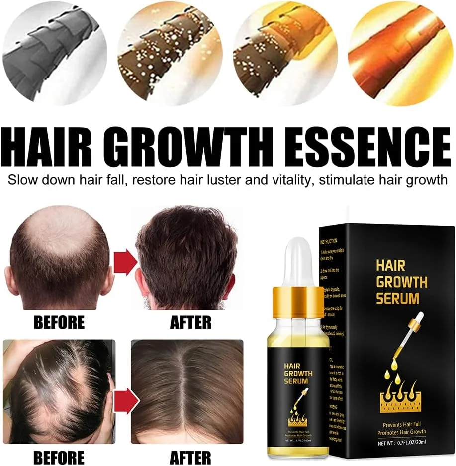 روغن موی جنسینگ و گردو NLLNT برای انواع مو، سرم رشد مو، روغن ترمیم عمقی پوست سر، روغن های ضد ریزش مو، درمان مو روغن موی جنسینگ و گردو NLLNT برای انواع مو، سرم رشد مو، روغن ترمیم عمقی پوست سر، روغن های ضد ریزش مو، درمان مو