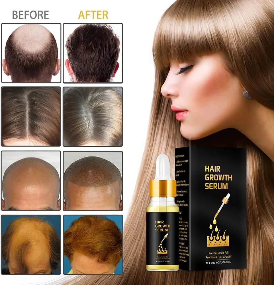 روغن موی جنسینگ و گردو NLLNT برای انواع مو، سرم رشد مو، روغن ترمیم عمقی پوست سر، روغن های ضد ریزش مو، درمان مو روغن موی جنسینگ و گردو NLLNT برای انواع مو، سرم رشد مو، روغن ترمیم عمقی پوست سر، روغن های ضد ریزش مو، درمان مو