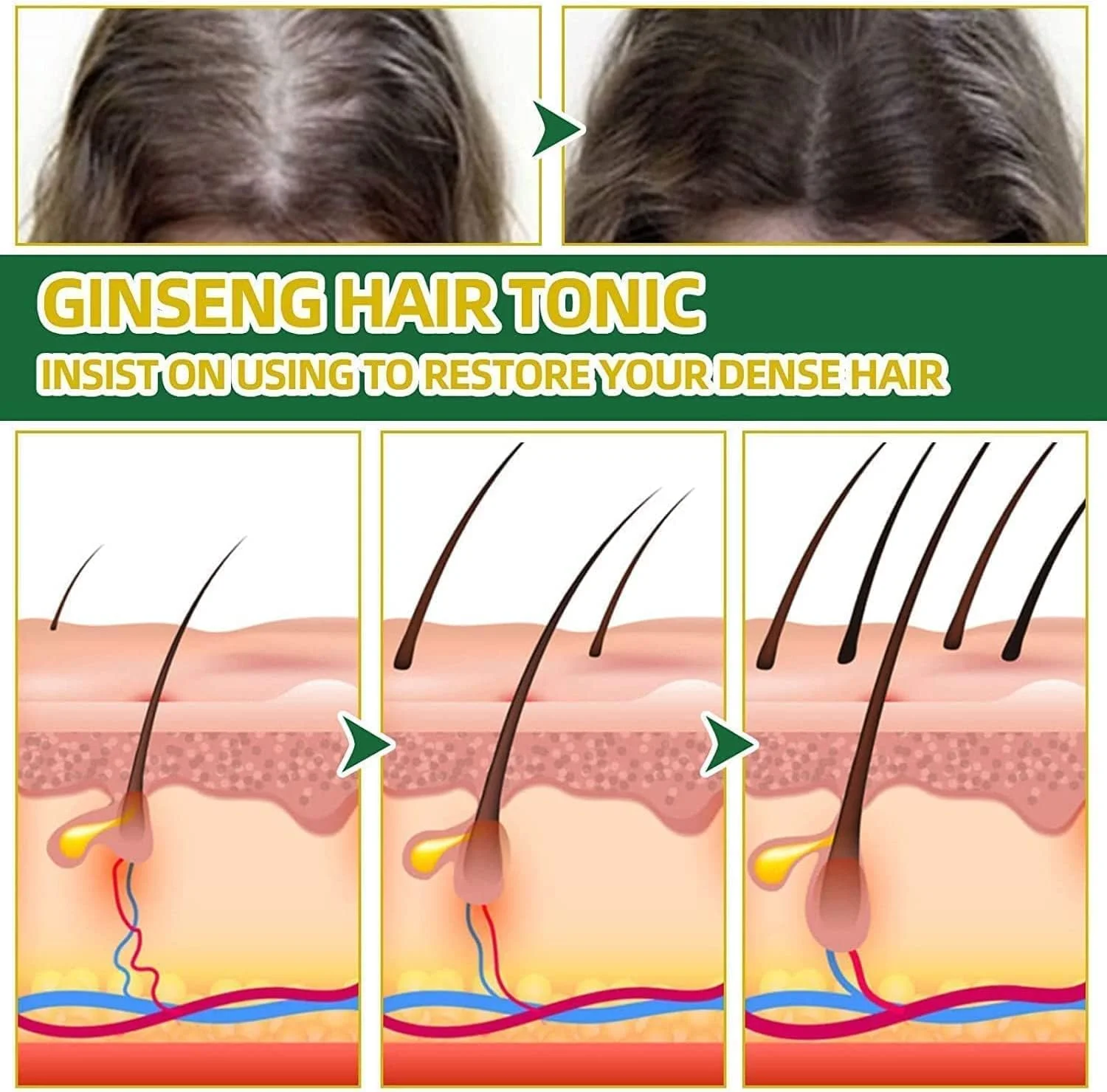 اسپری احیا کننده مو با عصاره جینسینگ قرمز، اسپری سرم رشد مجدد مو جینسینگ کره ای هیونگانگ، اسپری سرم رشد مو زنجبیلی، اسانس رشد مجدد مو برای زنان و مردان، ضد ریزش مو و رشد مجدد مو (1 عدد) اسپری احیا کننده مو با عصاره جینسینگ قرمز، اسپری سرم رشد مجدد مو جینسینگ کره ای هیونگانگ، اسپری سرم رشد مو زنجبیلی، اسانس رشد مجدد مو برای زنان و مردان، ضد ریزش مو و رشد مجدد مو (1 عدد)