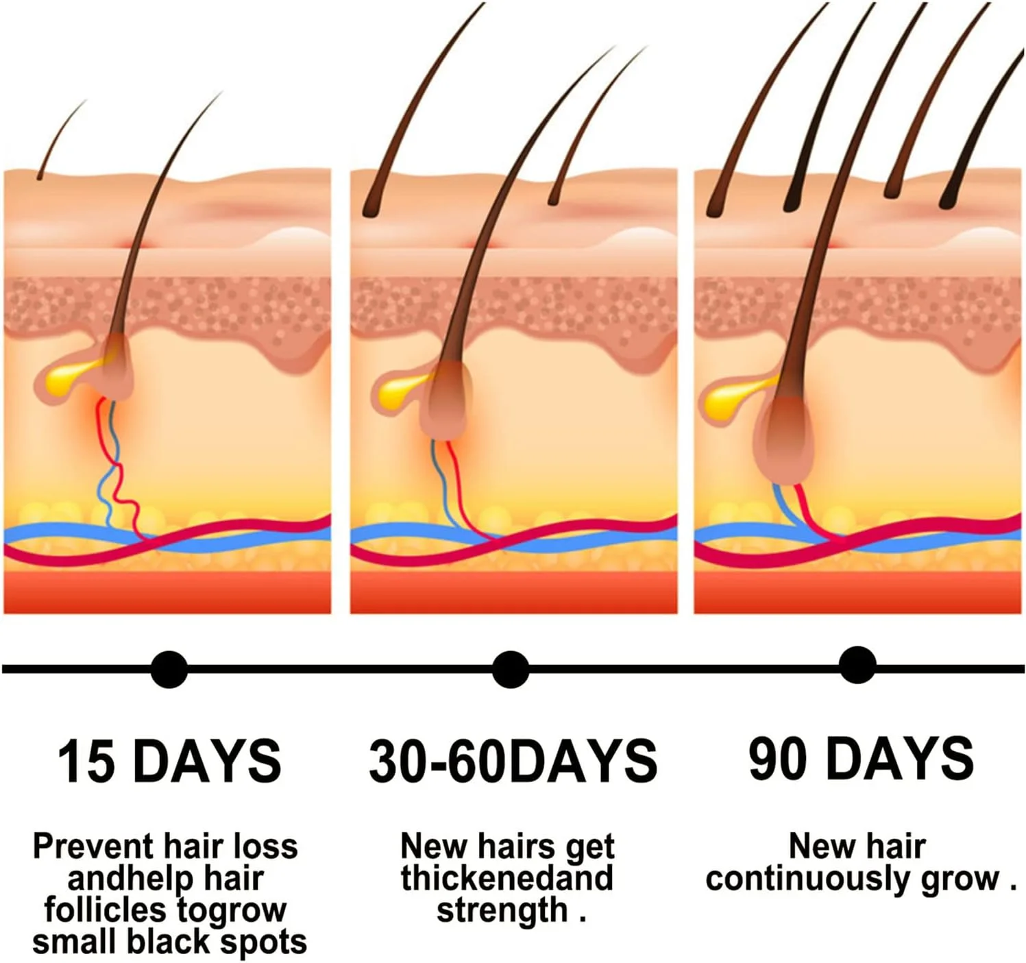روغن جوانه زنجبیل برای رشد مو، روغن رشد مو، سرم رشد مو جوانه زنجبیل، اسپری رشد زنجبیل و Polygonum Multiflorum، ضد ریزش مو، رویش مجدد مو برای مردان و زنان (3 عدد)