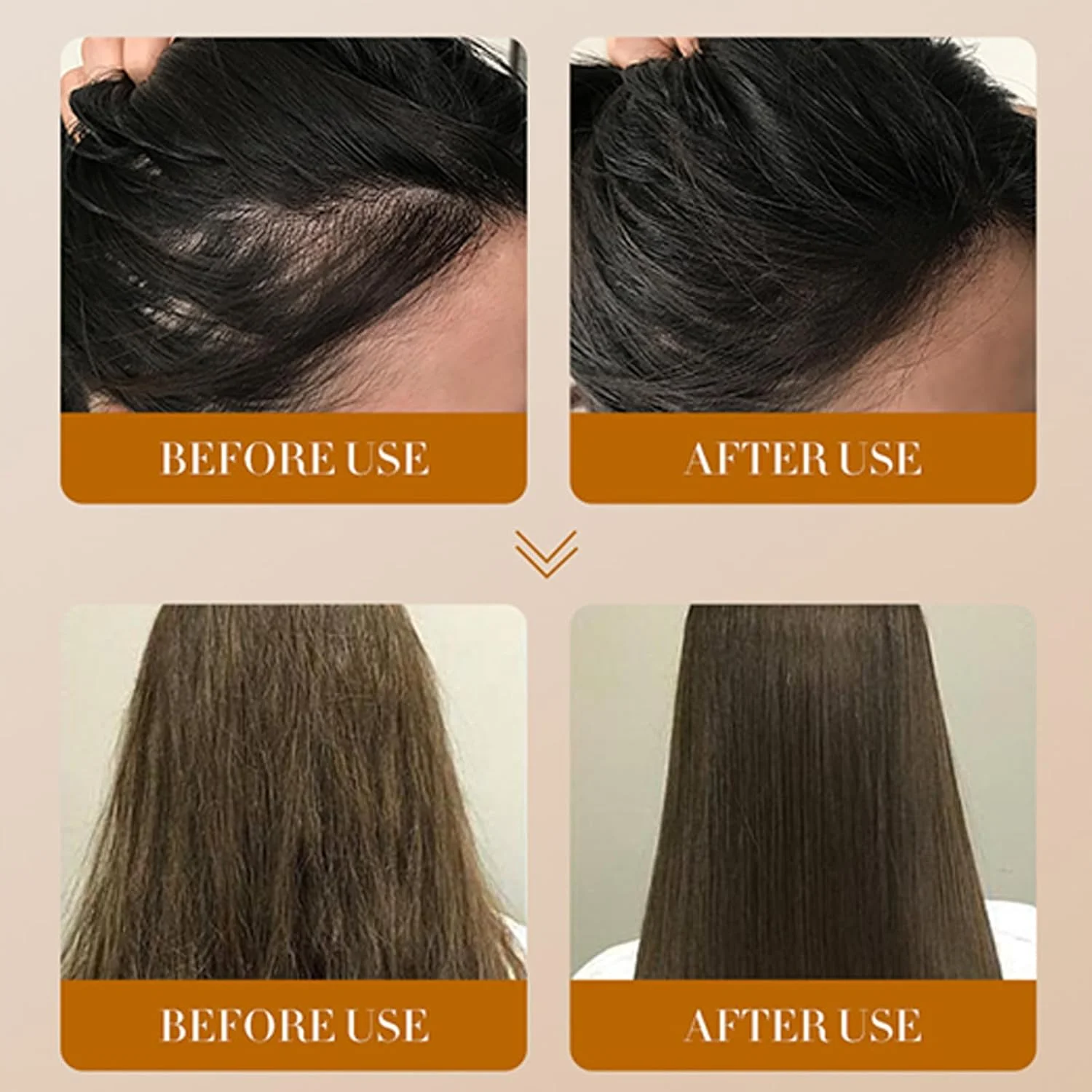 اسانس رشد مو زنجبیلی، اسانس زنجبیل ضد ریزش مو، روغن رشد مو، سرم زنجبیل، ضد ریزش مو، اسانس مو