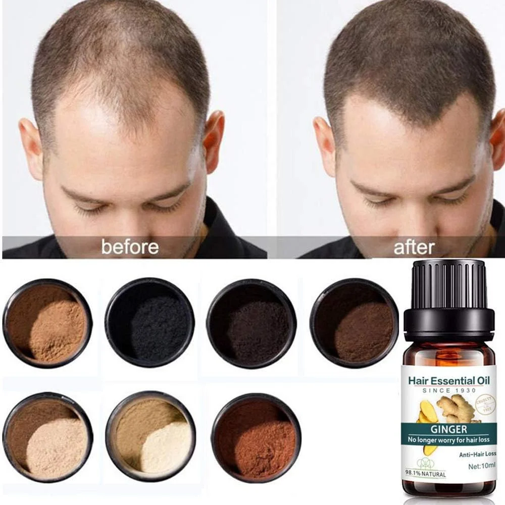 روغن زنجبیل ضروری، سرم رشد مو، روغن زنجبیل رشد مو، جلوگیری از ریزش مو، تقویت رشد مجدد مو