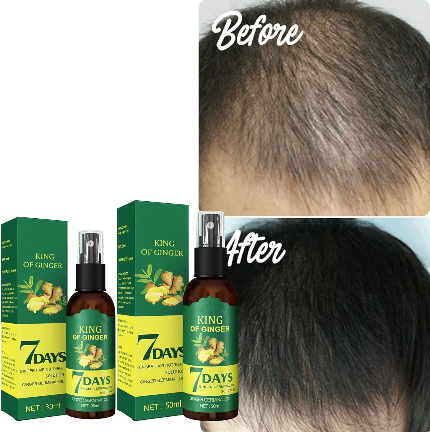 اسپری سرم زنجبیل، سرم گیاهی 7 روزه، اسپری رشد مو زنجبیل، درمان رشد مجدد مو با مواد طبیعی برای رشد سریع مو، ترمیم موهای آسیب دیده، برای مردان و زنان (50 میلی لیتر) اسپری سرم زنجبیل، سرم گیاهی 7 روزه، اسپری رشد مو زنجبیل، درمان رشد مجدد مو با مواد طبیعی برای رشد سریع مو، ترمیم موهای آسیب دیده، برای مردان و زنان (50 میلی لیتر)