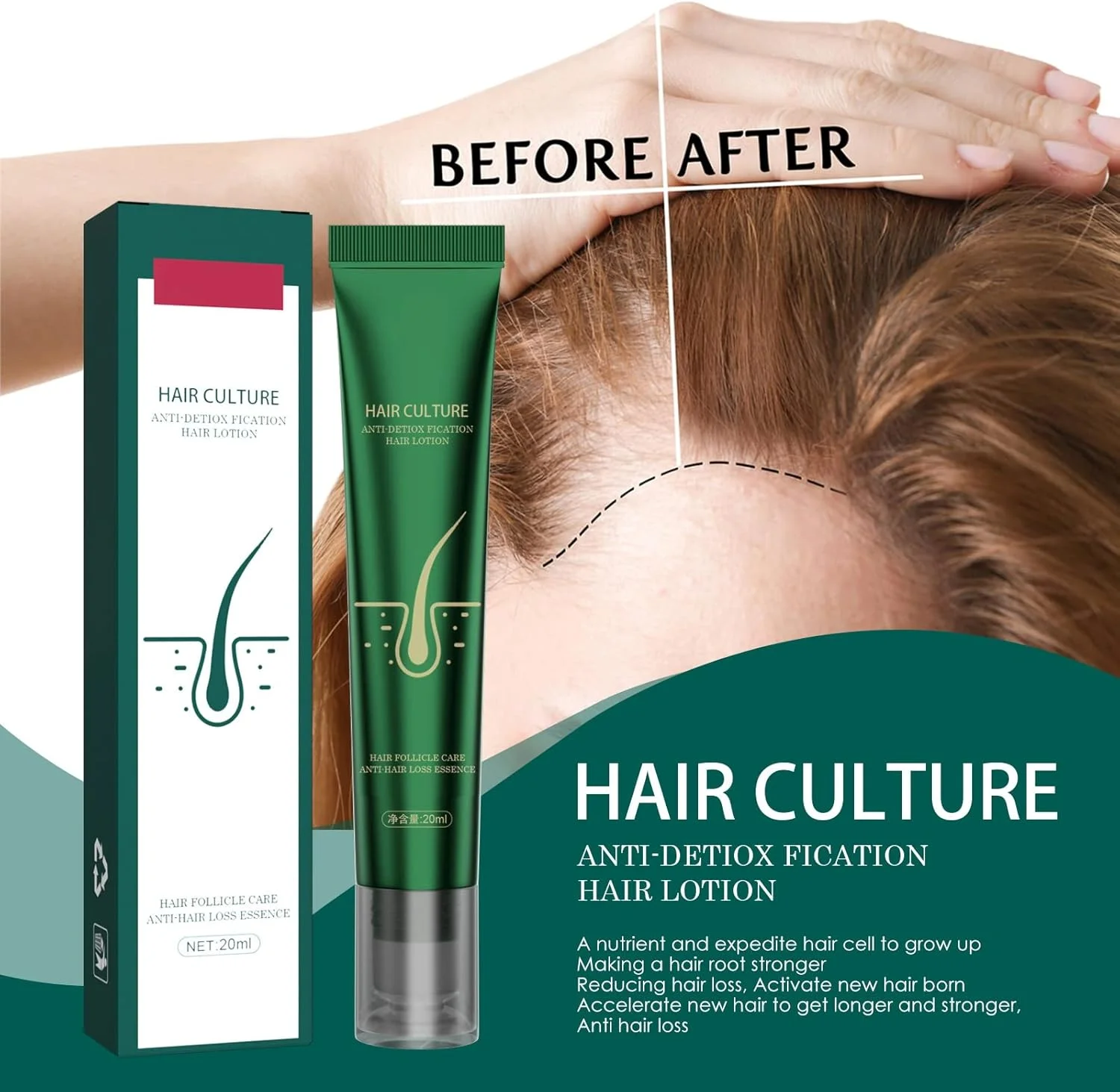 لوسیون سرم رشد مو زنجبیلی، اسانس رویش مجدد مو زنجبیلی، ماساژور سه غلتکی برای موهای ضخیم تر و قوی تر، درمان جلوگیری از ریزش مو (بسته 3 عددی 20 میلی لیتر) لوسیون سرم رشد مو زنجبیلی، اسانس رویش مجدد مو زنجبیلی، ماساژور سه غلتکی برای موهای ضخیم تر و قوی تر، درمان جلوگیری از ریزش مو (بسته 3 عددی 20 میلی لیتر)