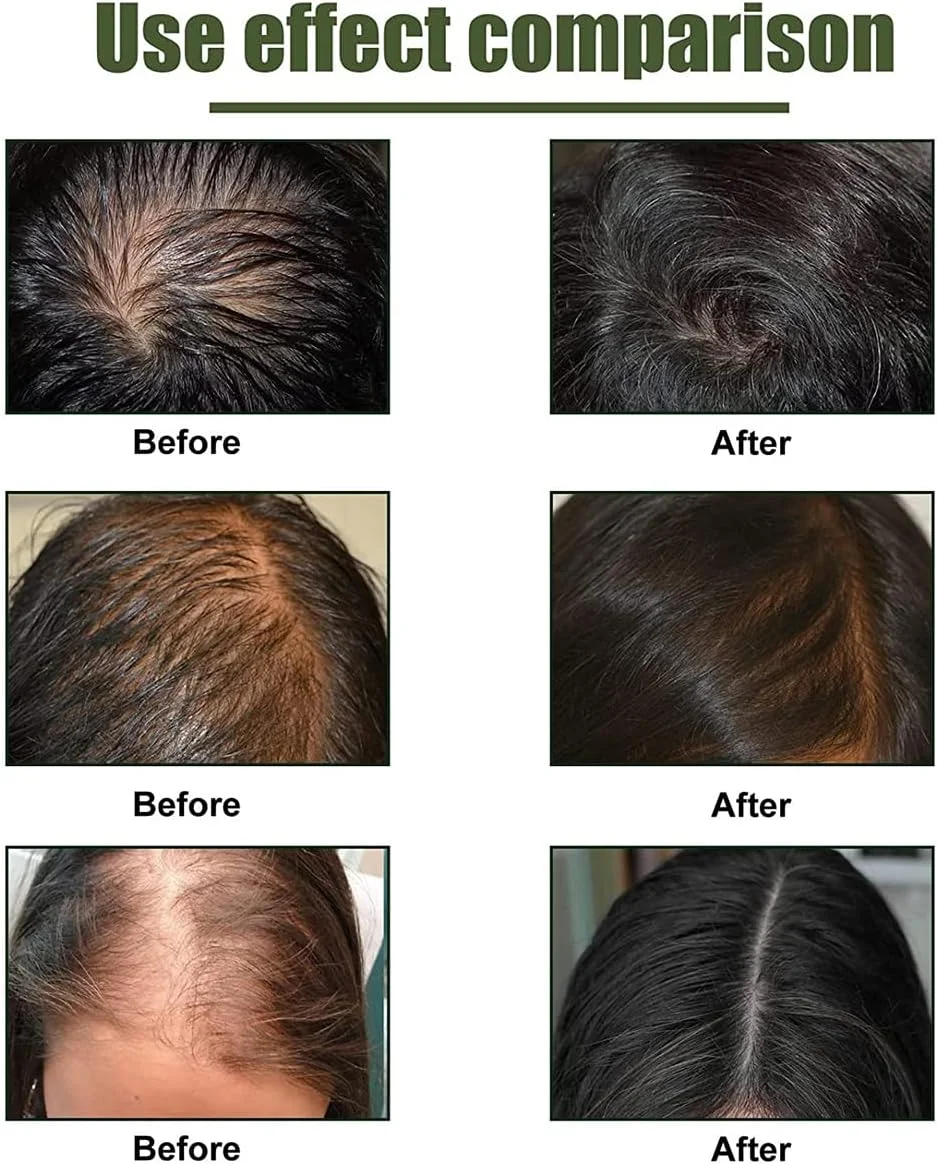 سرم معکوس کننده فولیکول مو FollicleRX NMN، سرم معکوس کننده فولیکول مو NMN، کمک به رفع نازک شدن مو، تغذیه کننده فولیکول های مو، ترمیم و رشد مجدد خط رویش مو (1 عدد) سرم معکوس کننده فولیکول مو FollicleRX NMN، سرم معکوس کننده فولیکول مو NMN، کمک به رفع نازک شدن مو، تغذیه کننده فولیکول های مو، ترمیم و رشد مجدد خط رویش مو (1 عدد)