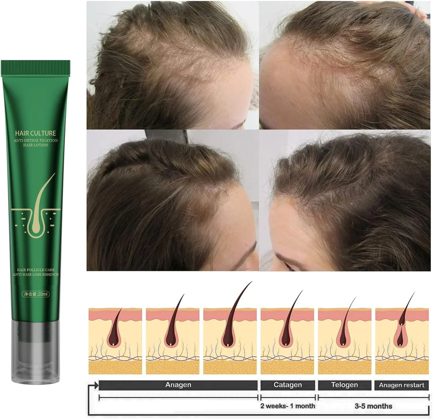 لوسیون سرم رشد مو زنجبیلی، اسانس رویش مجدد مو زنجبیلی، ماساژور سه غلتکی برای موهای ضخیم تر و قوی تر، درمان جلوگیری از ریزش مو (بسته 3 عددی 20 میلی لیتر) لوسیون سرم رشد مو زنجبیلی، اسانس رویش مجدد مو زنجبیلی، ماساژور سه غلتکی برای موهای ضخیم تر و قوی تر، درمان جلوگیری از ریزش مو (بسته 3 عددی 20 میلی لیتر)