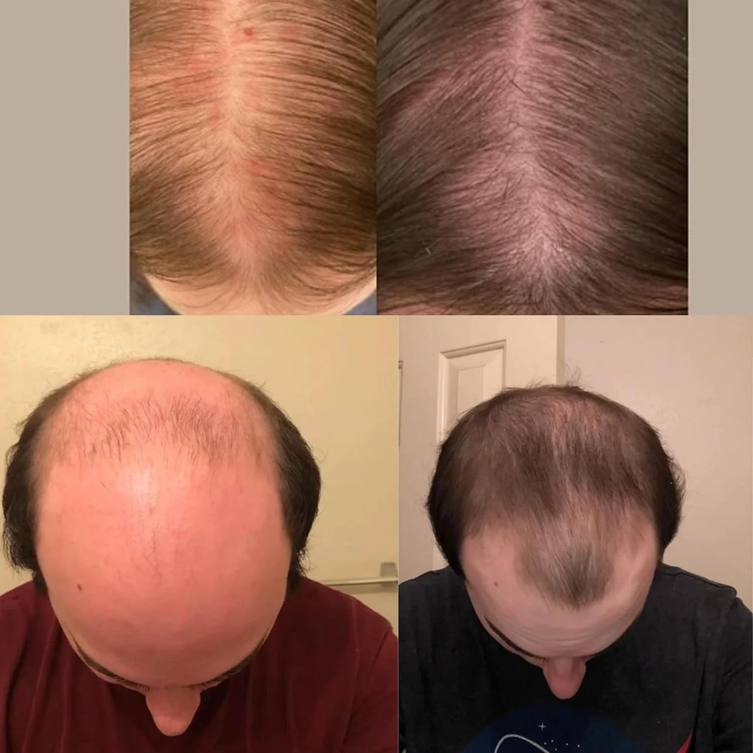 فرمول عمومی رشد مو، رشد مو، سرم رشد مو، روغن رشد مو، سرم رشد مو Folix 22، روغن های طبیعی مو برای رشد مو (2 عدد) فرمول عمومی رشد مو، رشد مو، سرم رشد مو، روغن رشد مو، سرم رشد مو Folix 22، روغن های طبیعی مو برای رشد مو (2 عدد)