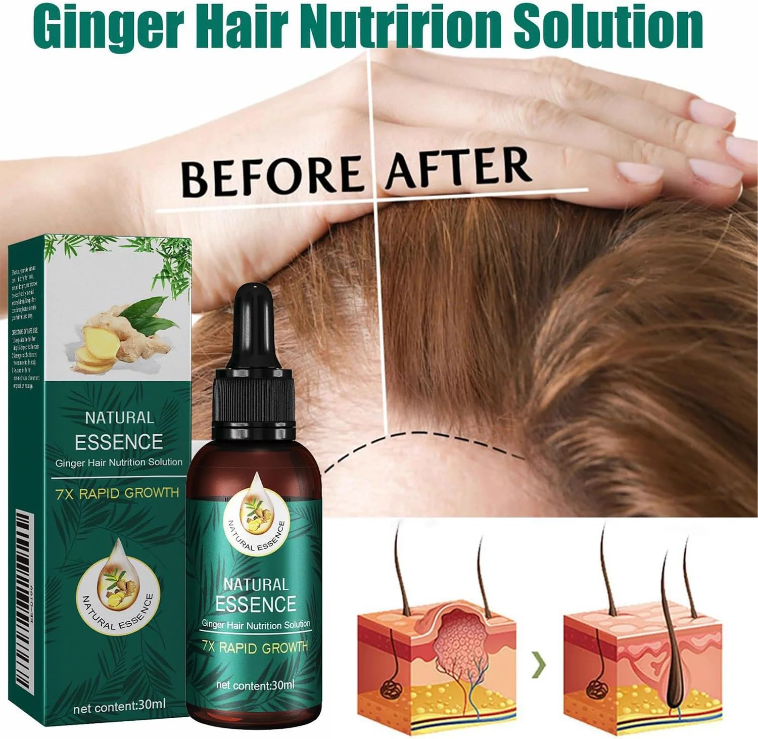 روغن مراقبت از مو فولوس، سرم رشد مو، سرم مو برای رشد مو، درخشان کننده، ترمیم کننده ریشه مو، مرطوب کننده مغذی برای موهای خشک و آسیب دیده، تقویت کننده 30 میلی لیتر روغن مراقبت از مو فولوس، سرم رشد مو، سرم مو برای رشد مو، درخشان کننده، ترمیم کننده ریشه مو، مرطوب کننده مغذی برای موهای خشک و آسیب دیده، تقویت کننده 30 میلی لیتر