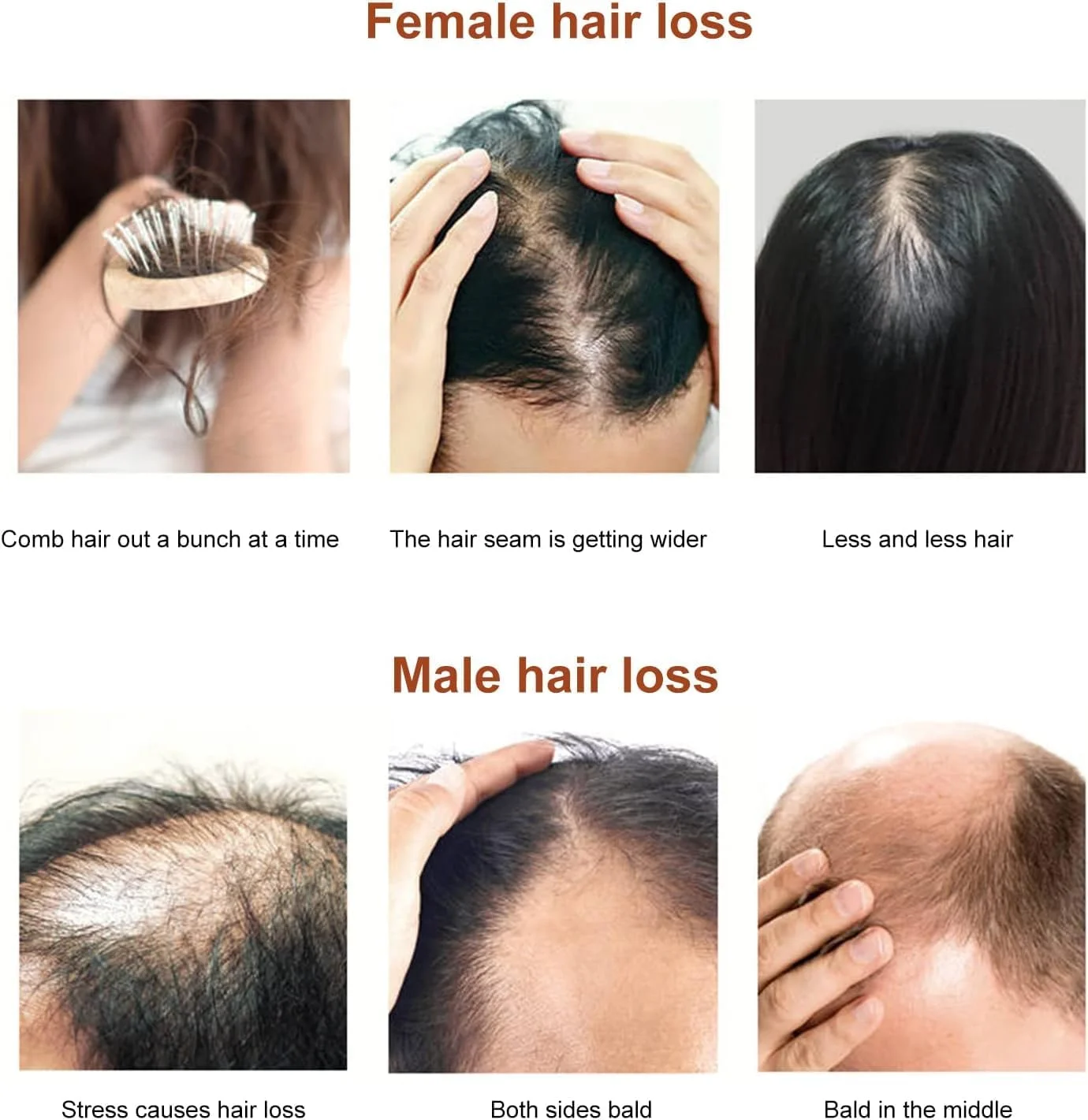 روغن مراقبت از مو فولوس، سرم رشد مو، سرم مو برای رشد مو، درخشان کننده، ترمیم کننده ریشه مو، مرطوب کننده مغذی برای موهای خشک و آسیب دیده، تقویت کننده 30 میلی لیتر روغن مراقبت از مو فولوس، سرم رشد مو، سرم مو برای رشد مو، درخشان کننده، ترمیم کننده ریشه مو، مرطوب کننده مغذی برای موهای خشک و آسیب دیده، تقویت کننده 30 میلی لیتر