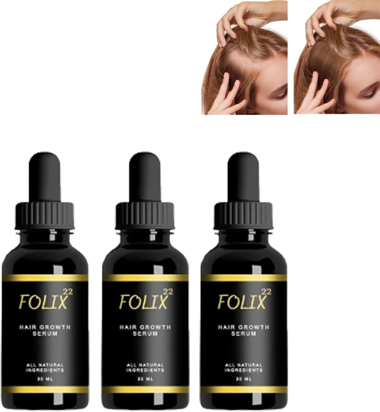 فرمول رشد مو Folix22، روغن رشد مو Folix22، سرم رشد مو Folix 22، روغن مغذی مو، روغن ضروری ضد ریزش مو برای موهای نازک و آسیب دیده (3 عدد)