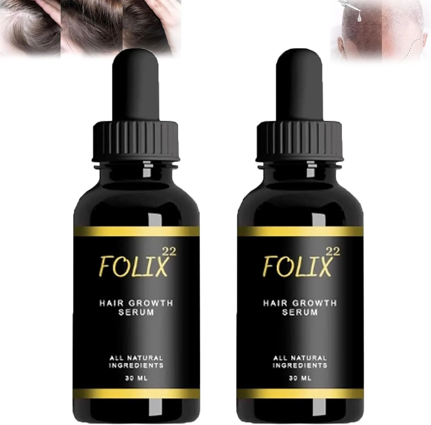 فرمول رشد مو Folix22، سرم رشد مو Folix 22، رشد مو Folix22، سیستم رشد مو Folix22، فرمول ضد ریزش مو Folix 22، روغن رشد مو Folix22، برای موهای نازک و آسیب دیده (2 عدد)