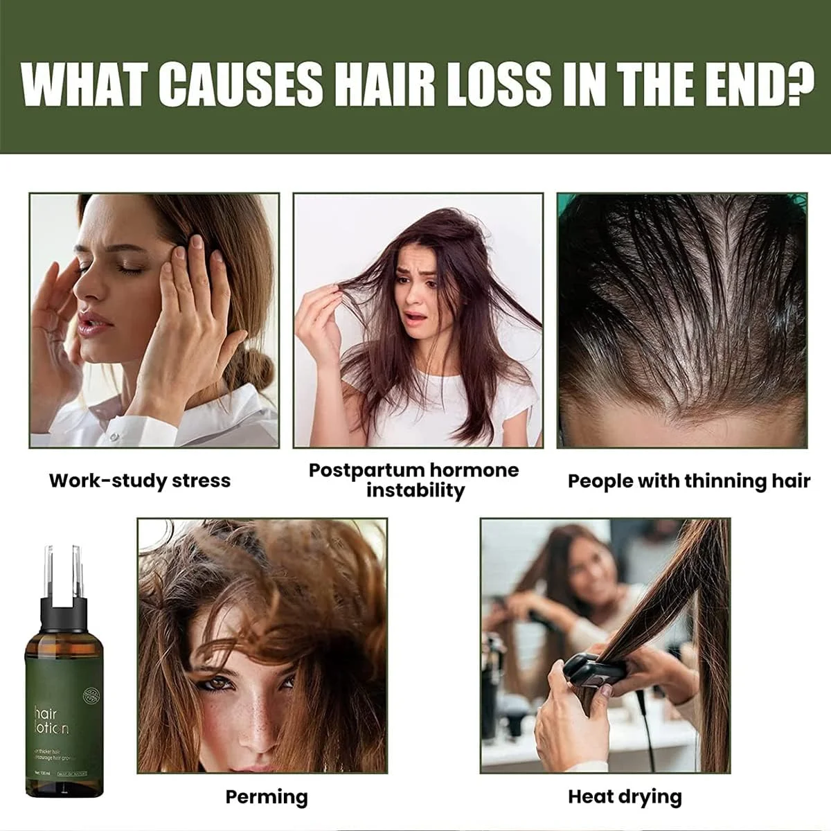 سرم معکوس کننده فولیکول NMN FollicleRX، سرم معکوس کننده فولیکول NMN، کمک به مقابله با نازک شدن مو، تغذیه کننده فولیکول های مو، ترمیم و رشد مجدد خط رویش مو (3 عدد)