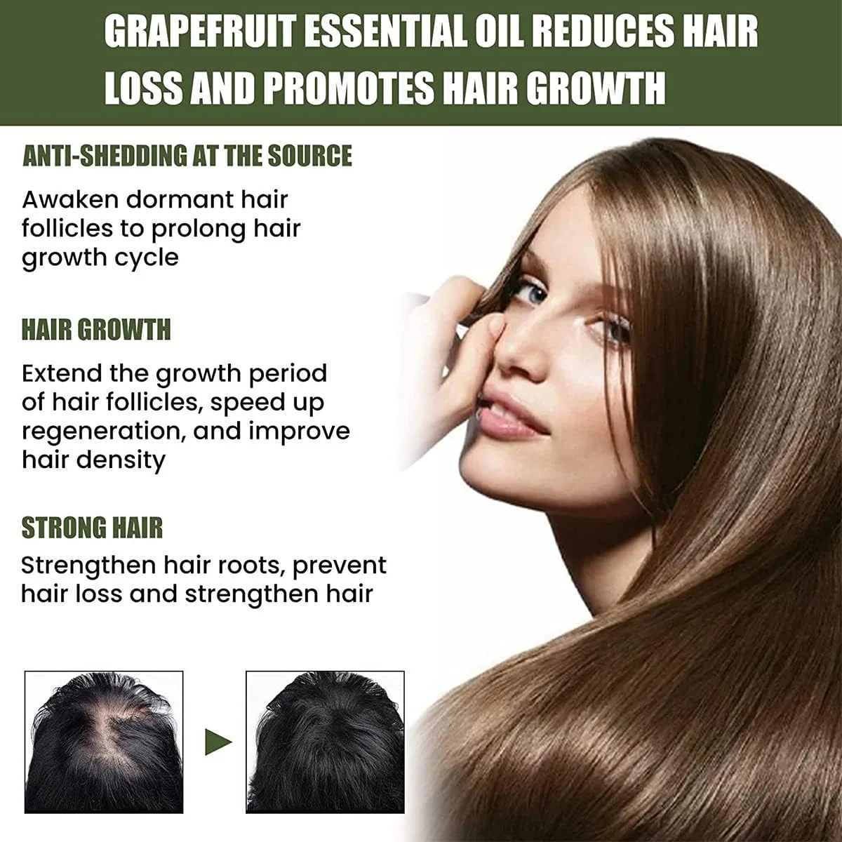 سرم معکوس کننده فولیکول NMN FollicleRX، سرم معکوس کننده فولیکول NMN، کمک به مقابله با نازک شدن مو، تغذیه کننده فولیکول های مو، ترمیم و رشد مجدد خط رویش مو (3 عدد)