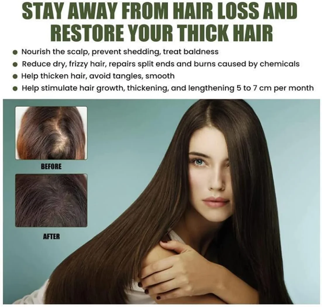 سرم معکوس کننده فولیکول NMN FollicleRX، سرم معکوس کننده فولیکول NMN، کمک به مقابله با نازک شدن مو، تغذیه کننده فولیکول های مو، ترمیم و رشد مجدد خط رویش مو (3 عدد)