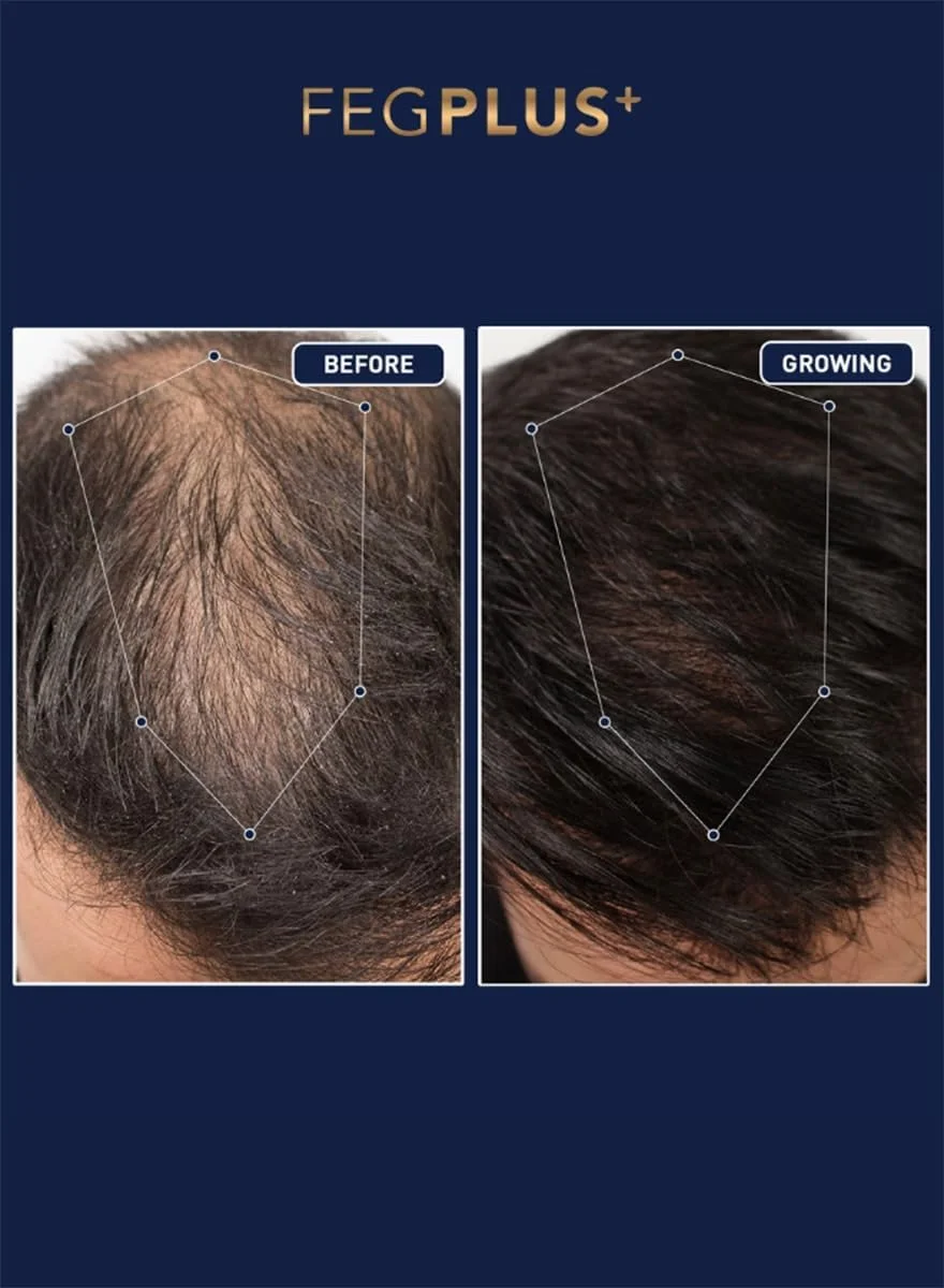 سرم رشد مو و ریش FEGPLUS دو عددی - کنترل ریزش و رشد مجدد، درمان با مواد طبیعی برای موهای قوی تر و سالم تر برای آقایان و بانوان سرم رشد مو و ریش FEGPLUS دو عددی - کنترل ریزش و رشد مجدد، درمان با مواد طبیعی برای موهای قوی تر و سالم تر برای آقایان و بانوان