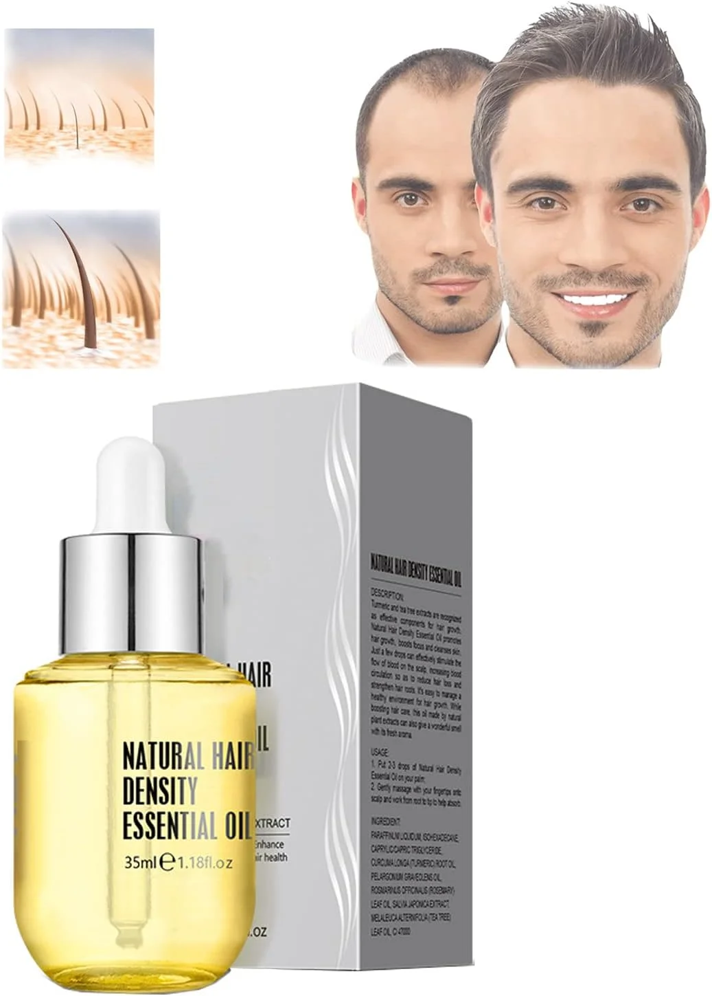 سرم مو زنجبیل Bavlio، سرم اسانس زنجبیل، سرم رشد مجدد مو زنجبیل، روغن ضروری طبیعی برای تراکم مو، سرم رشد سریع مو برای موهای نازک زنان و مردان (1 عدد)