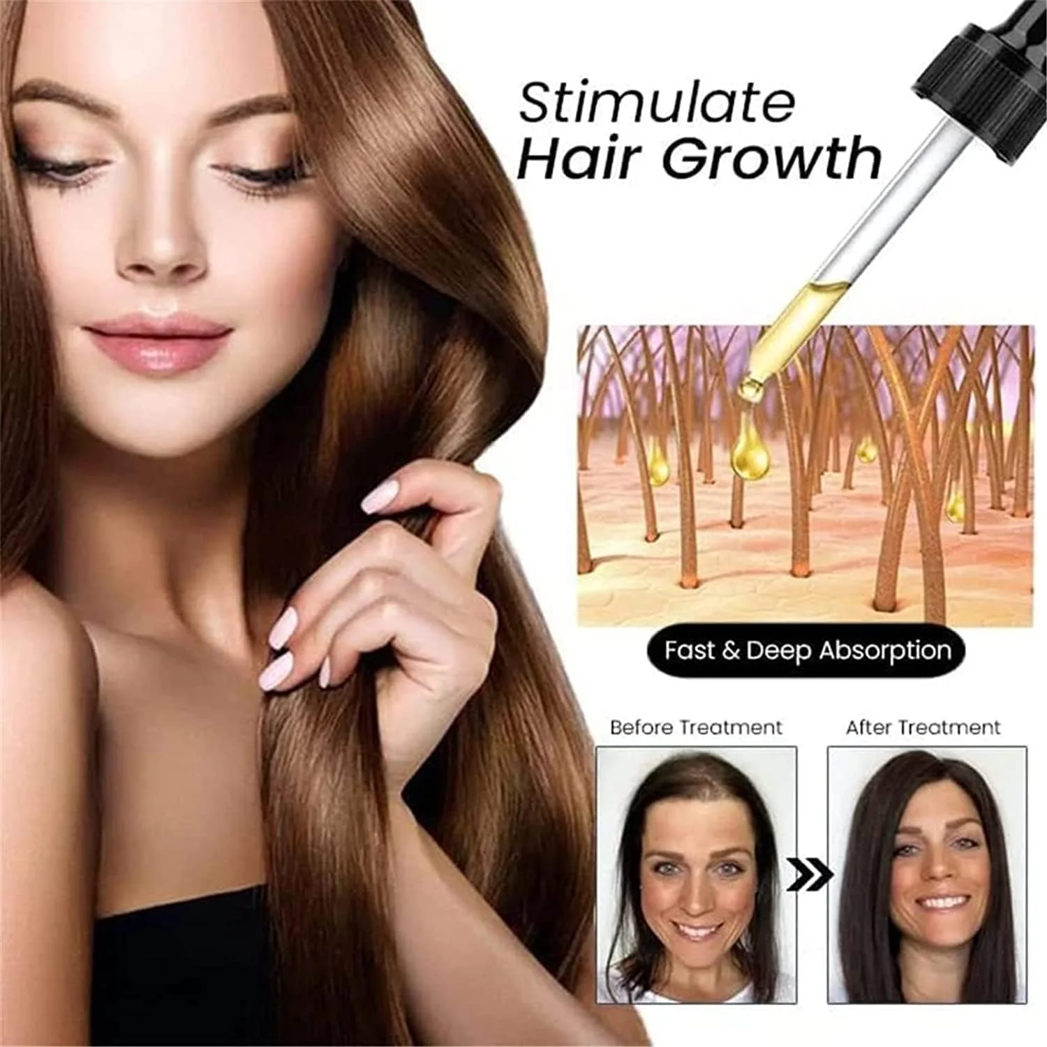 سرم مو با عصاره زنجبیل، سرم رشد مجدد مو با زنجبیل، روغن مو با عصاره زنجبیل برای جلوگیری از ریزش مو، تقویت کننده و ضخیم کننده مو برای مردان و زنان، 30 میلی لیتر (1 عدد)