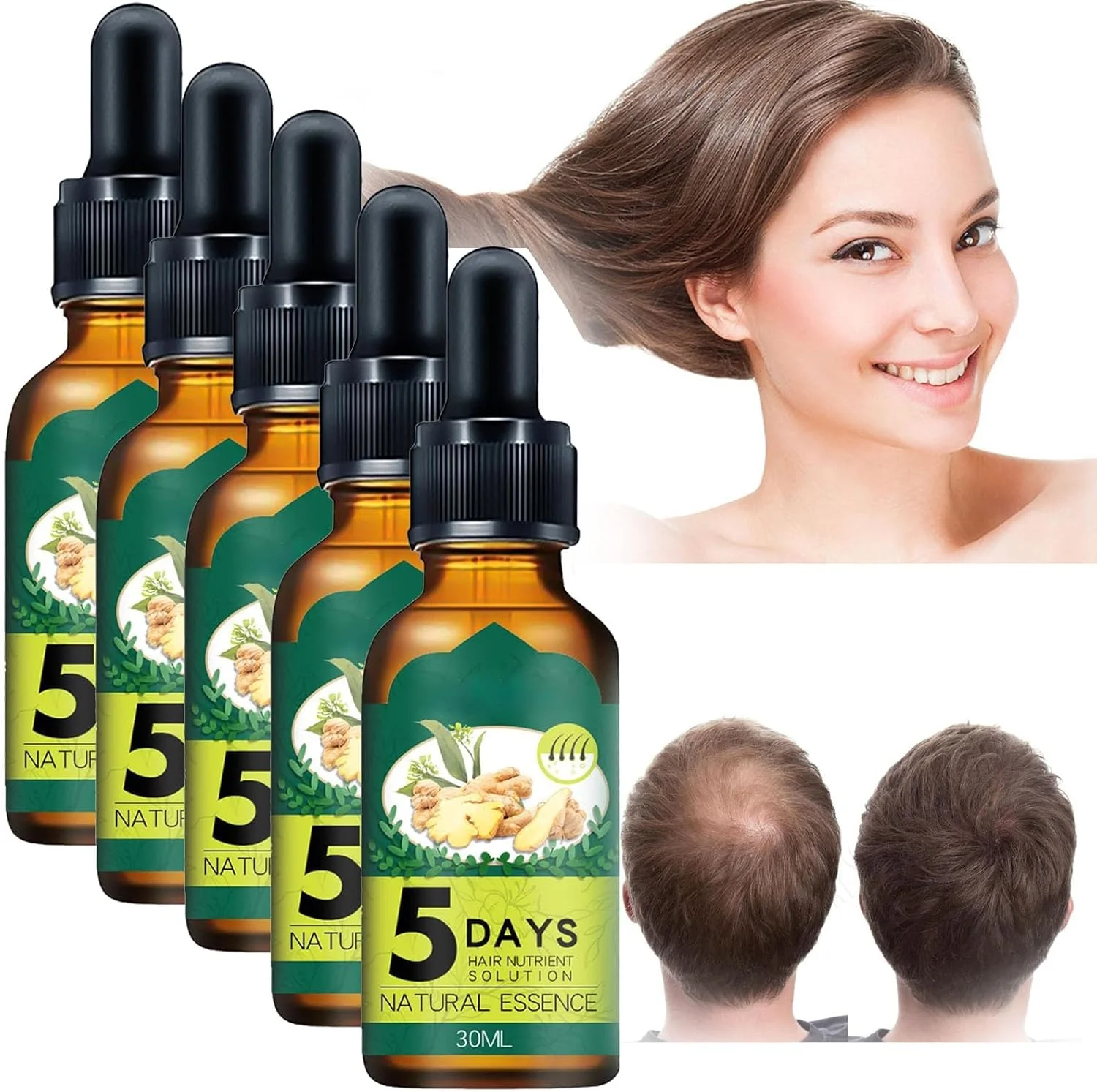 روغن تقویت کننده مو Essence، سرم روغن ضروری مراقبت از مو زنجبیلی، محلول مغذی مو 5 روزه، اسپری رشد مو زنجبیلی، محصولات رشد مو زنجبیلی 5 روزه برای رشد و ضخامت (5 عدد)