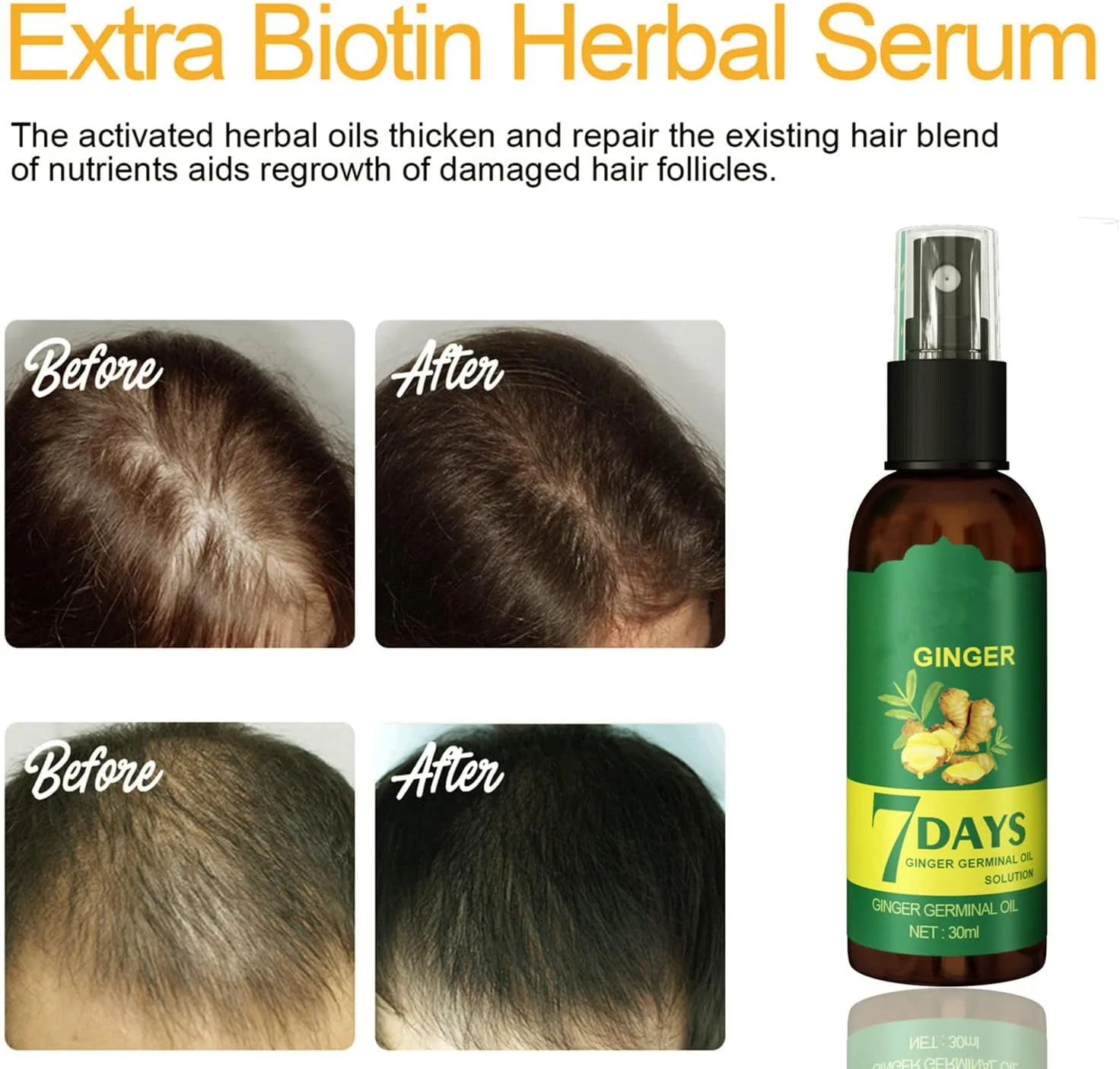 سرم رشد مو 7 روزه، اسانس ضد ریزش مو، روغن اسانس سرم جوانه زنجبیل 7 روزه، محلول مغذی مو زنجبیل 7 روزه، اسانس گیاهی طبیعی برای موهای کم پشت و نازک (2 عدد)