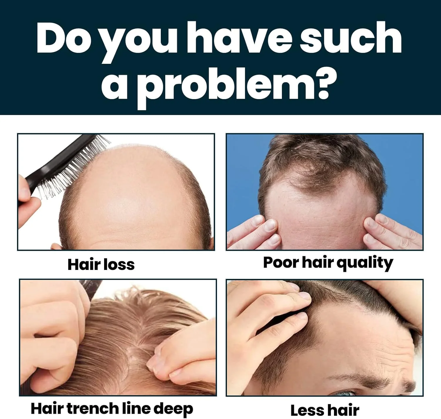 محلول مغذی متراکم کننده موی مردانه، مراقبت تغذیه ای، ضد ریزش، ضخیم کننده و مرطوب کننده برای سلامت مو