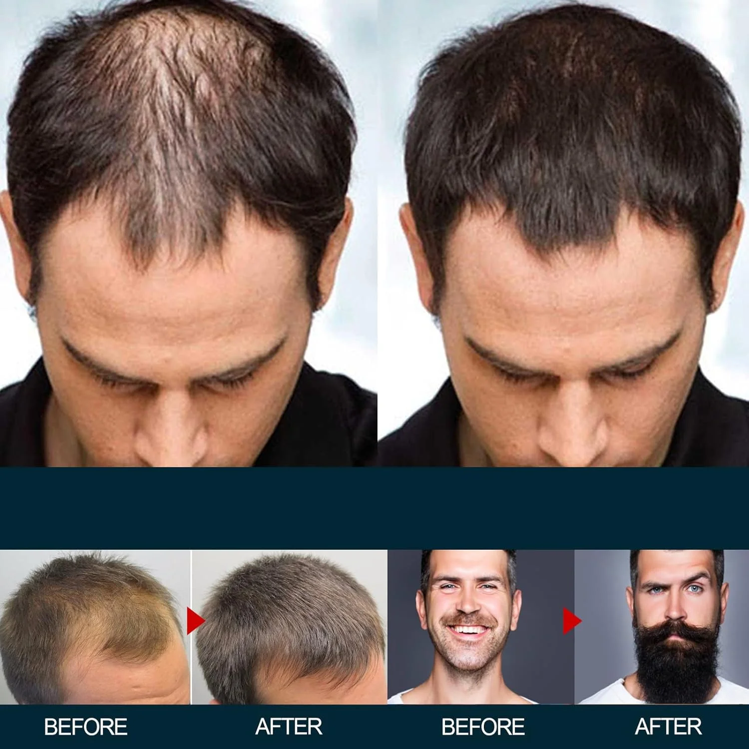 محلول مغذی متراکم کننده موی مردانه، مراقبت تغذیه ای، ضد ریزش، ضخیم کننده و مرطوب کننده برای سلامت مو