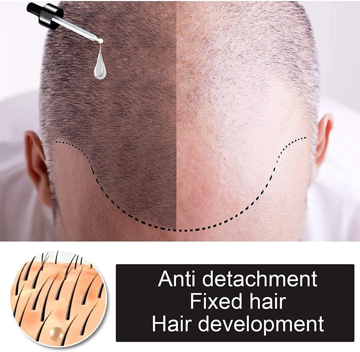 سرم موی قوی 10X-Regro برای رشد سریع مو، درمان 30 میلی لیتر، ترمیم فولیکول های مو، نازک شدن مو، درمان طاسی، تقویت موهای ضخیم تر و قوی تر، مایع درمان ریزش مو برای زنان و مردان، ضخیم کننده مو