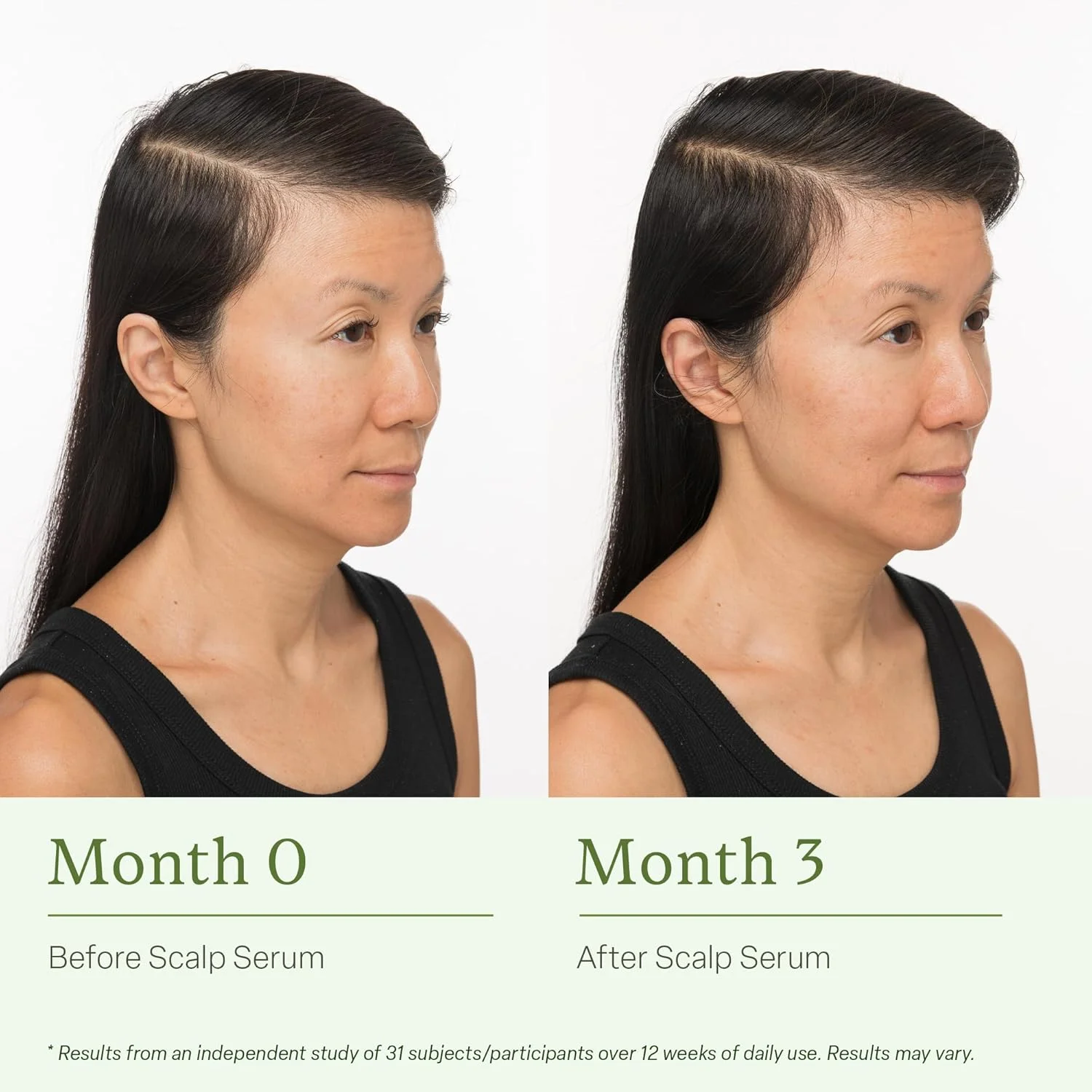 سرم پوست سر موی دیوی برای زنان و مردان - احیا و متعادل کننده پوست سر - بهبود ظاهر موهای نازک، تغذیه پوست سر و کمک به از بین بردن تجمع محصول و چربی، 30 میلی لیتر سرم پوست سر موی دیوی برای زنان و مردان - احیا و متعادل کننده پوست سر - بهبود ظاهر موهای نازک، تغذیه پوست سر و کمک به از بین بردن تجمع محصول و چربی، 30 میلی لیتر