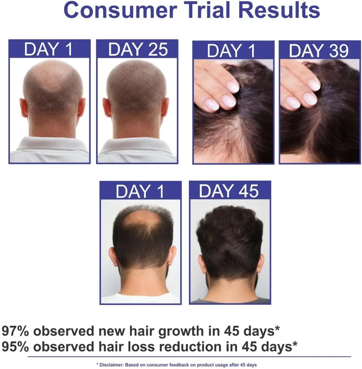 سرم رشد مو دکتر آتییست برای زنان و مردان، ردنسيل 3% آناگین، 2% بایکاپیل، کافئین، بیوتین، کراتین گیاهی و آب برنج - ضد وز، آبرسان، ترمیم کننده، بدون سولفات، مواد ارگانیک، ویتامین E، 110 گرم