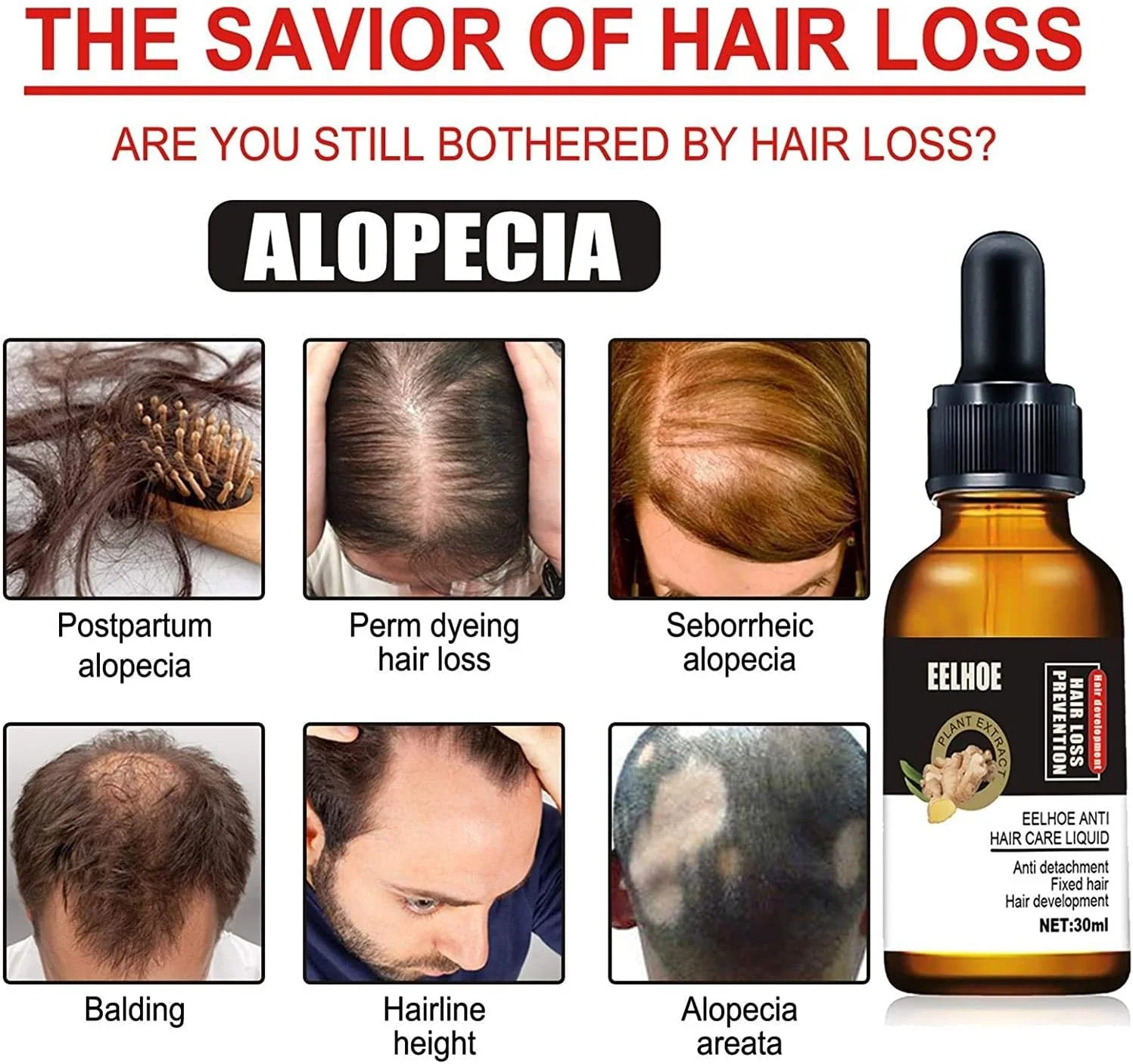 سرم موی قوی 10X-Regro برای رشد سریع مو، درمان 30 میلی لیتر، ترمیم فولیکول های مو، نازک شدن مو، درمان طاسی، تقویت موهای ضخیم تر و قوی تر، مایع درمان ریزش مو برای زنان و مردان، ضخیم کننده مو