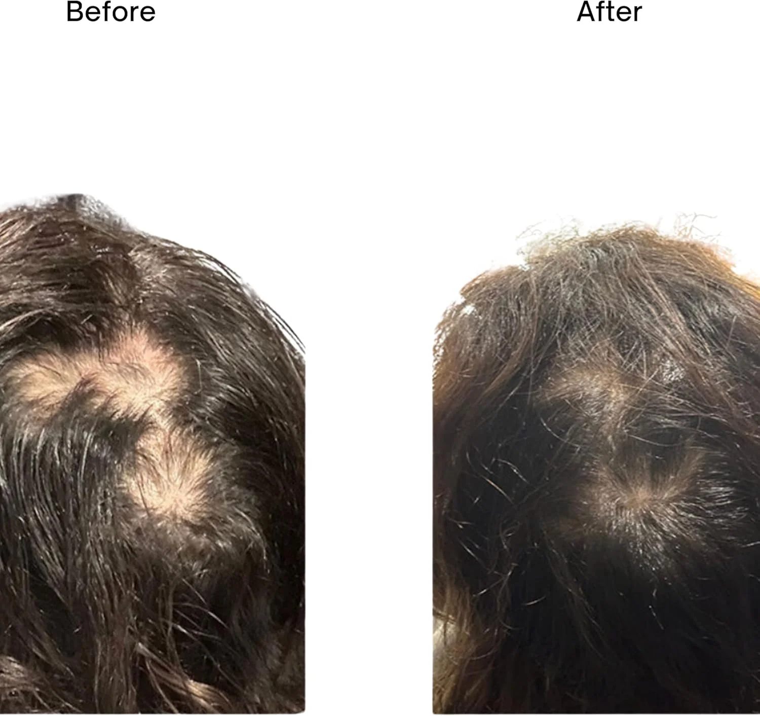 سرم رشد مو دیپلی - تقویت شده با مولتی ویتامین برای انواع مو و مراقبت از مو، تغذیه کننده پوست سر، تقویت کننده تارهای مو، درمان رشد مو برای موهای ضخیم تر و سالم تر، 30 میلی لیتر سرم رشد مو دیپلی - تقویت شده با مولتی ویتامین برای انواع مو و مراقبت از مو، تغذیه کننده پوست سر، تقویت کننده تارهای مو، درمان رشد مو برای موهای ضخیم تر و سالم تر، 30 میلی لیتر