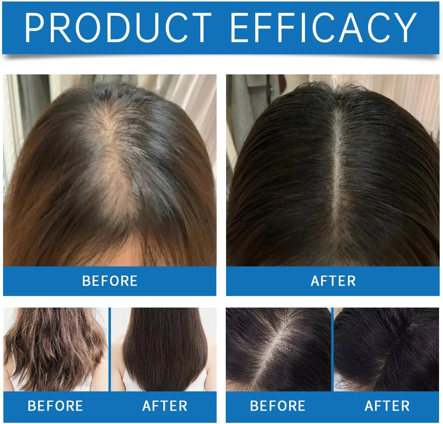 آمپول خنک کننده موی سر، آمپول خنک کننده موی سر، سرم مو برای ریزش مو، خنک کننده و طراوت بخش پوست سر، درمان ریزش مو، تقویت و رشد مو، سرم رشد مو